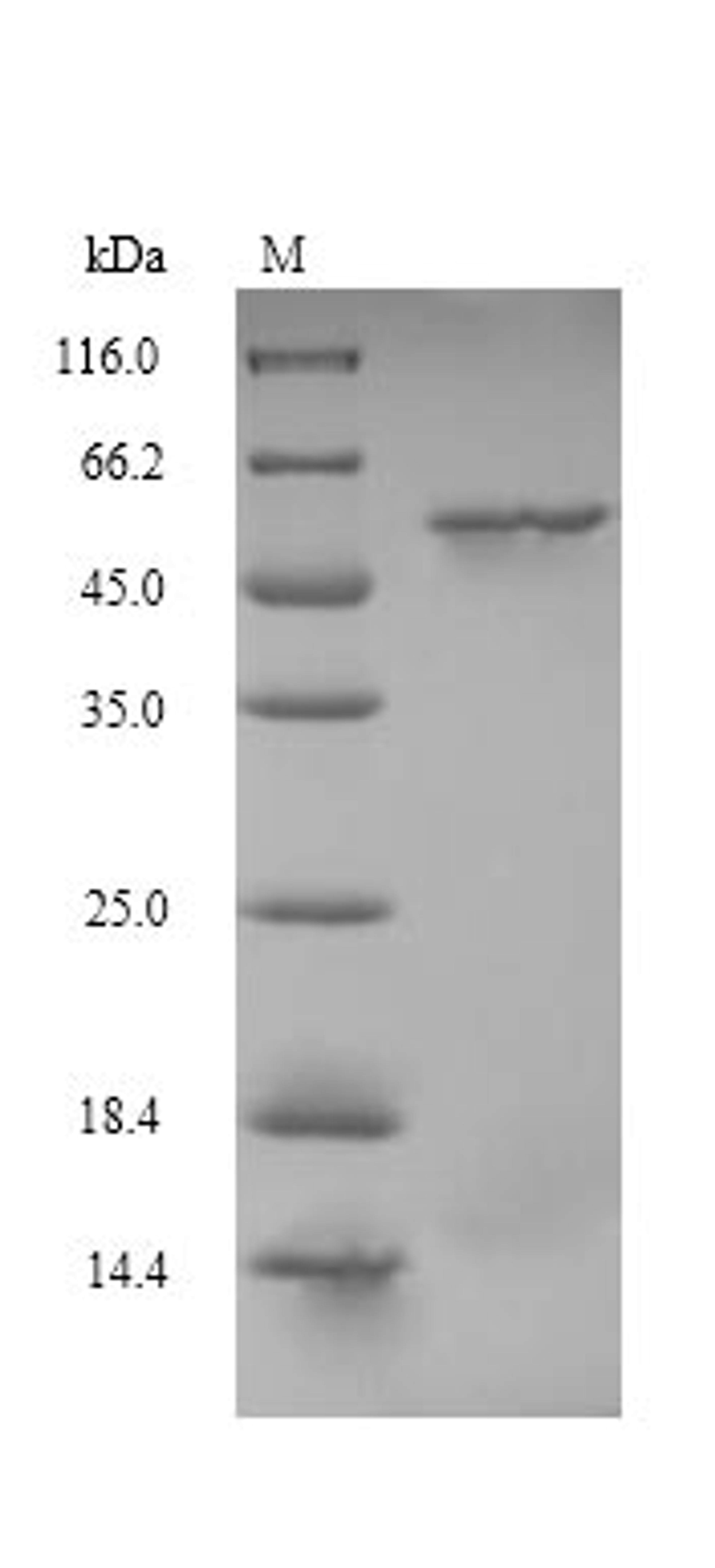 (Tris-Glycine gel) Discontinuous SDS-PAGE (reduced) with 5% enrichment gel and 15% separation gel.