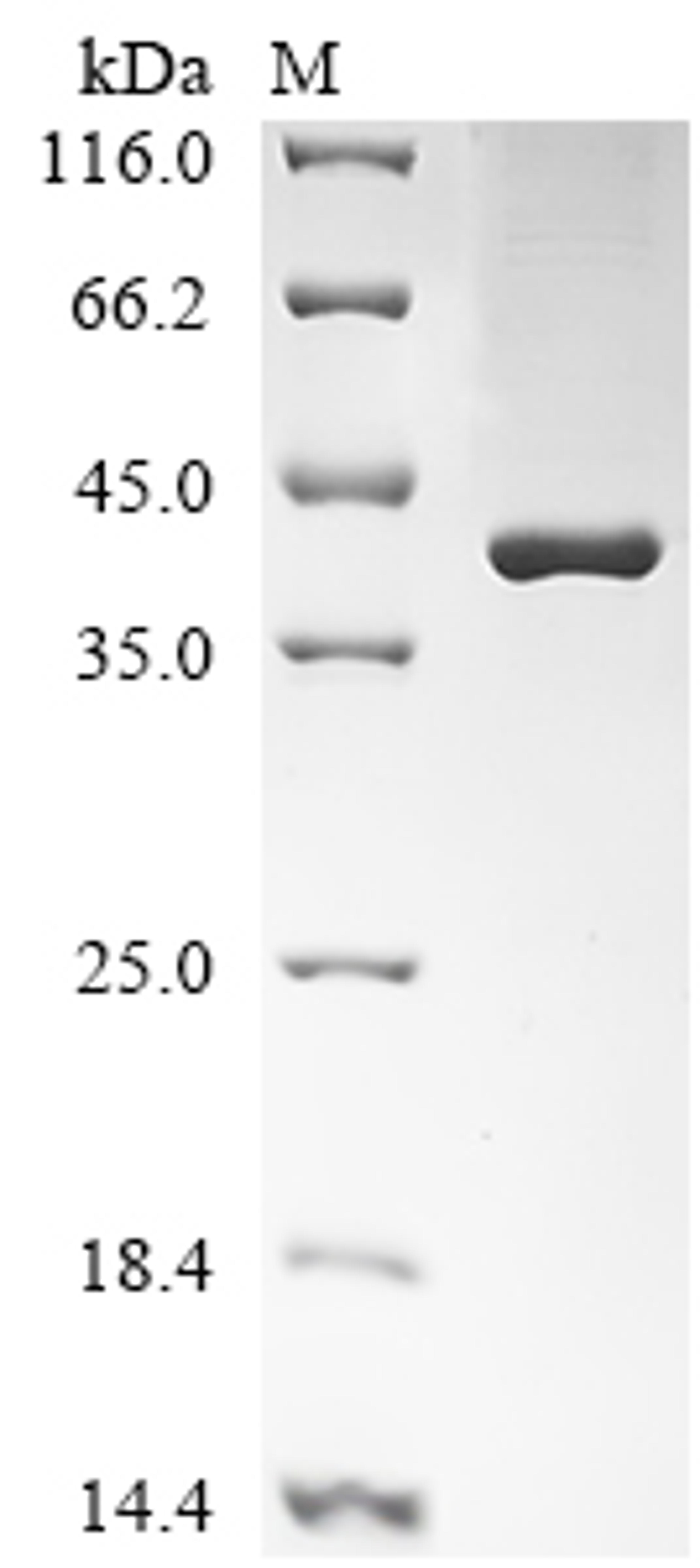 (Tris-Glycine gel) Discontinuous SDS-PAGE (reduced) with 5% enrichment gel and 15% separation gel.