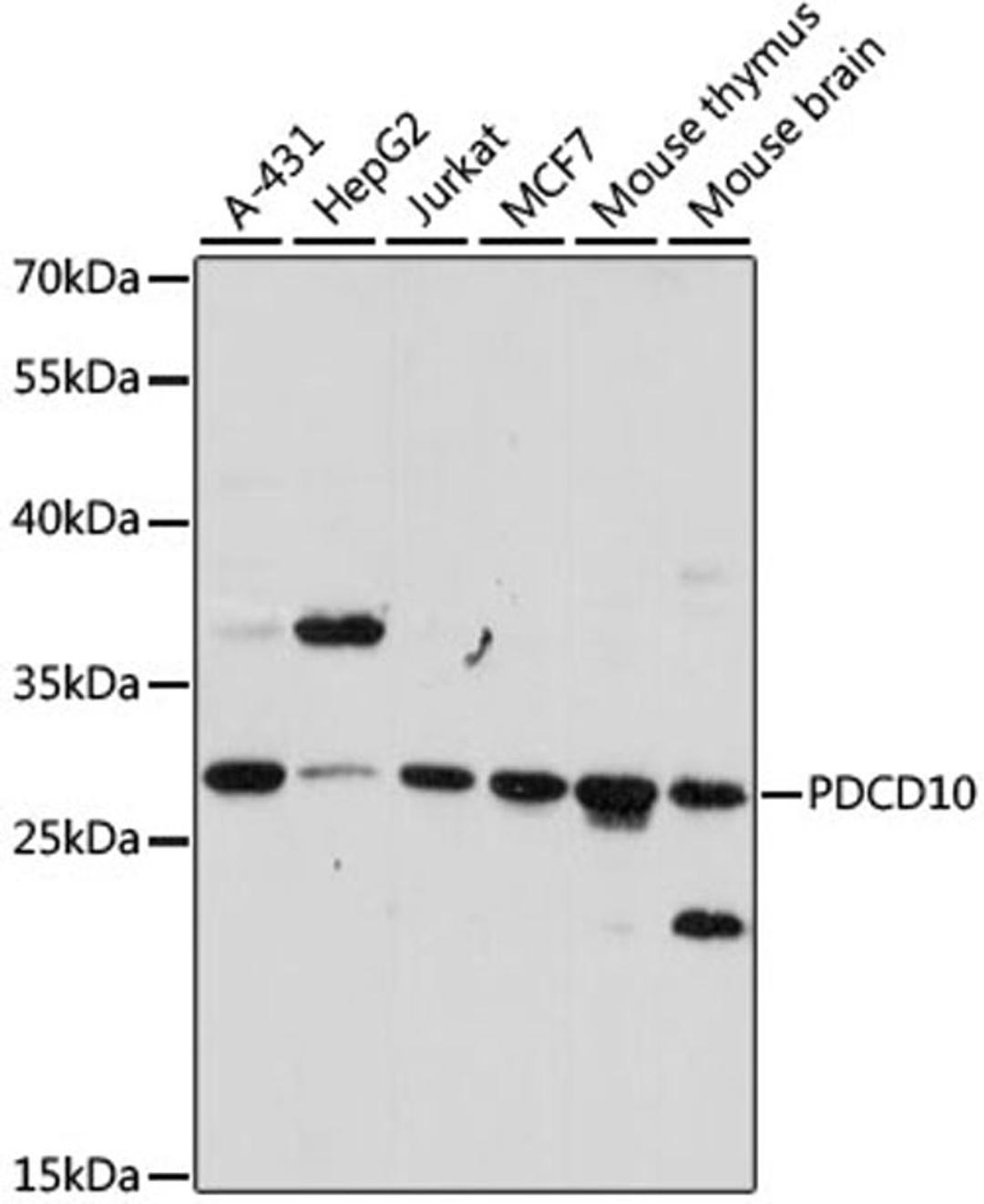 Western blot - PDCD10 antibody (A15400)