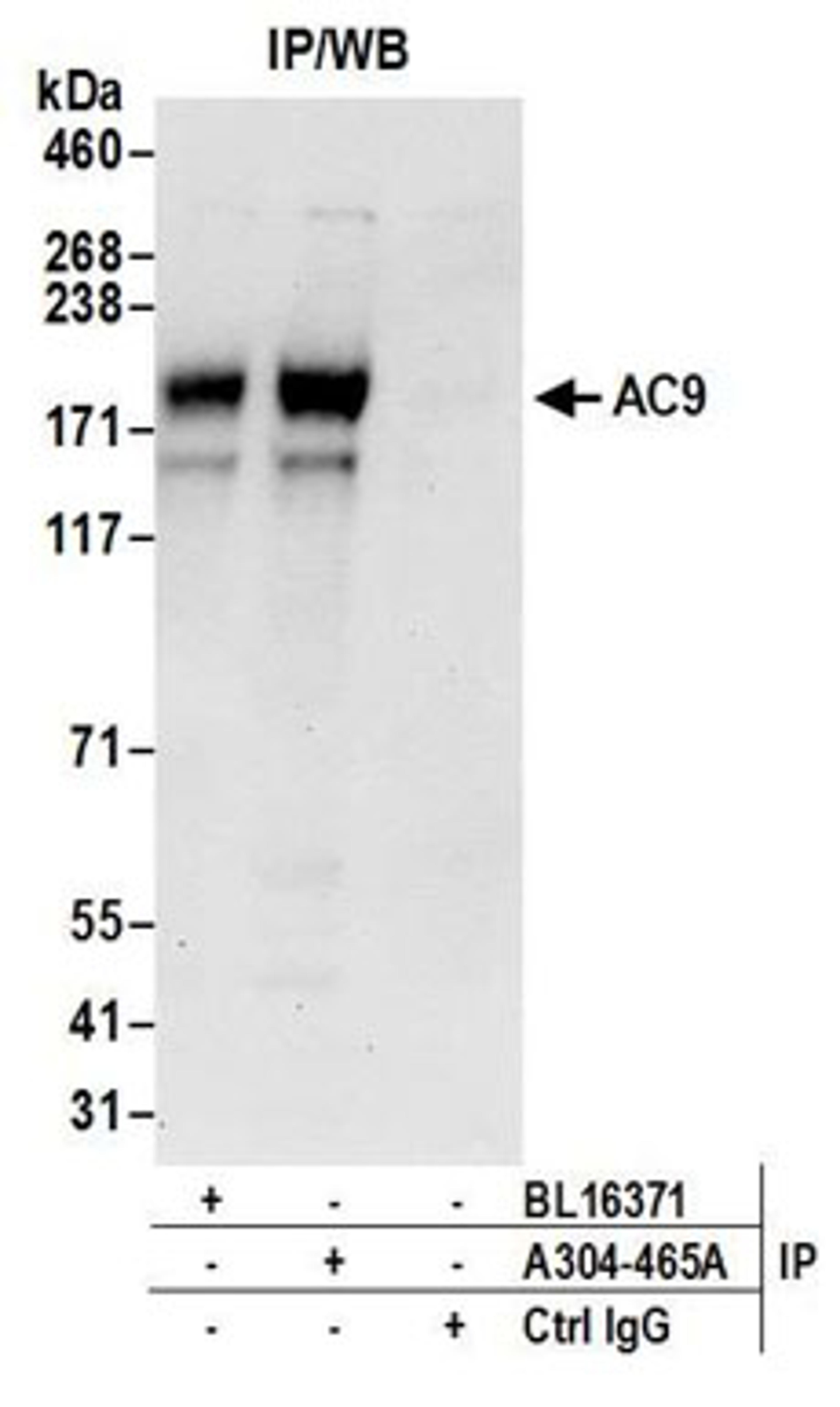 Detection of human AC9 by western blot of immunoprecipitates.