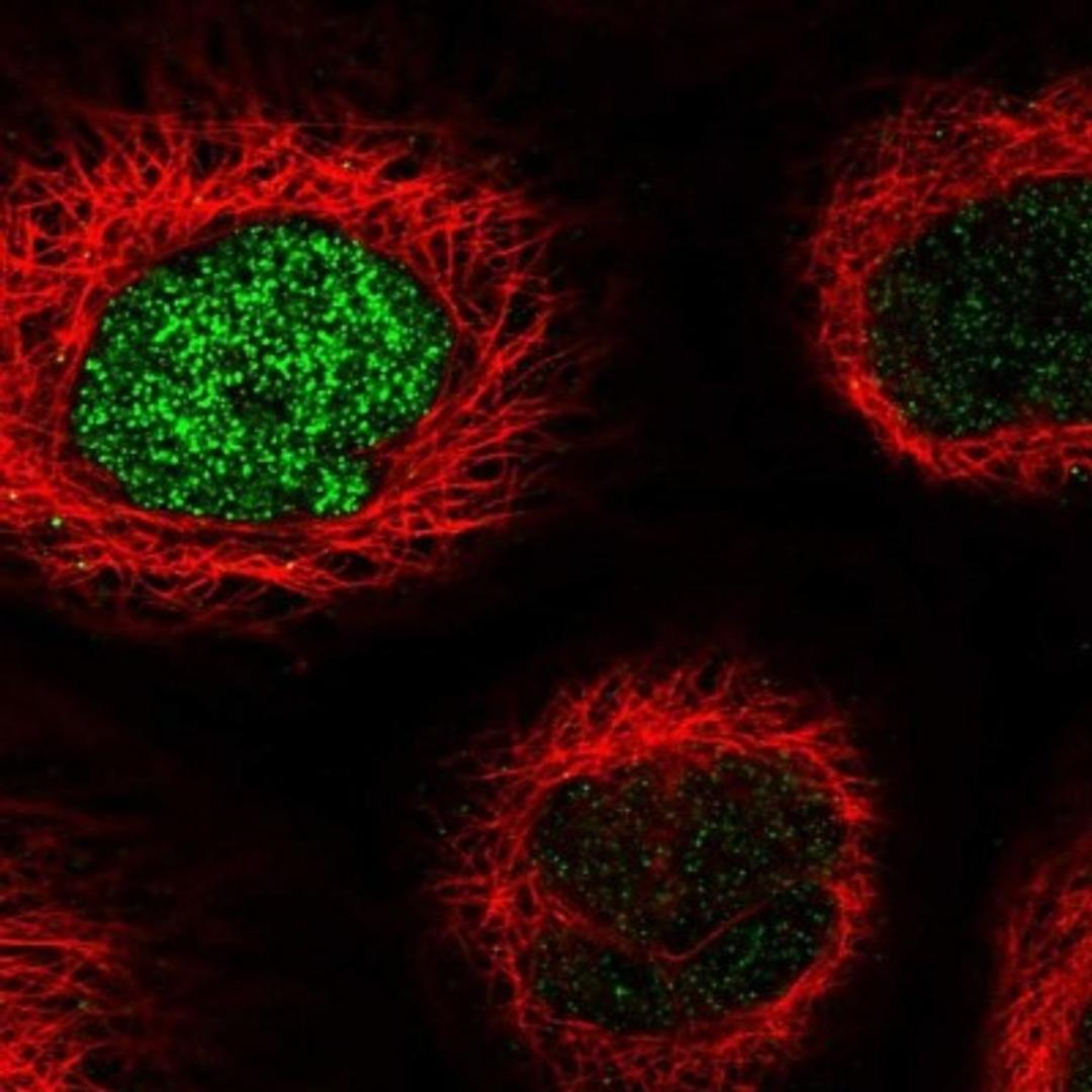 Immunocytochemistry/Immunofluorescence: OBSL1 Antibody [NBP1-93625] - Staining of human cell line A-431 shows positivity in nucleus but not nucleoli.