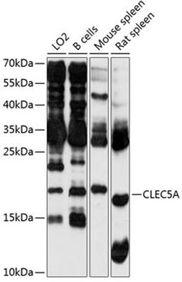 Western blot - CLEC5A antibody (A2873)