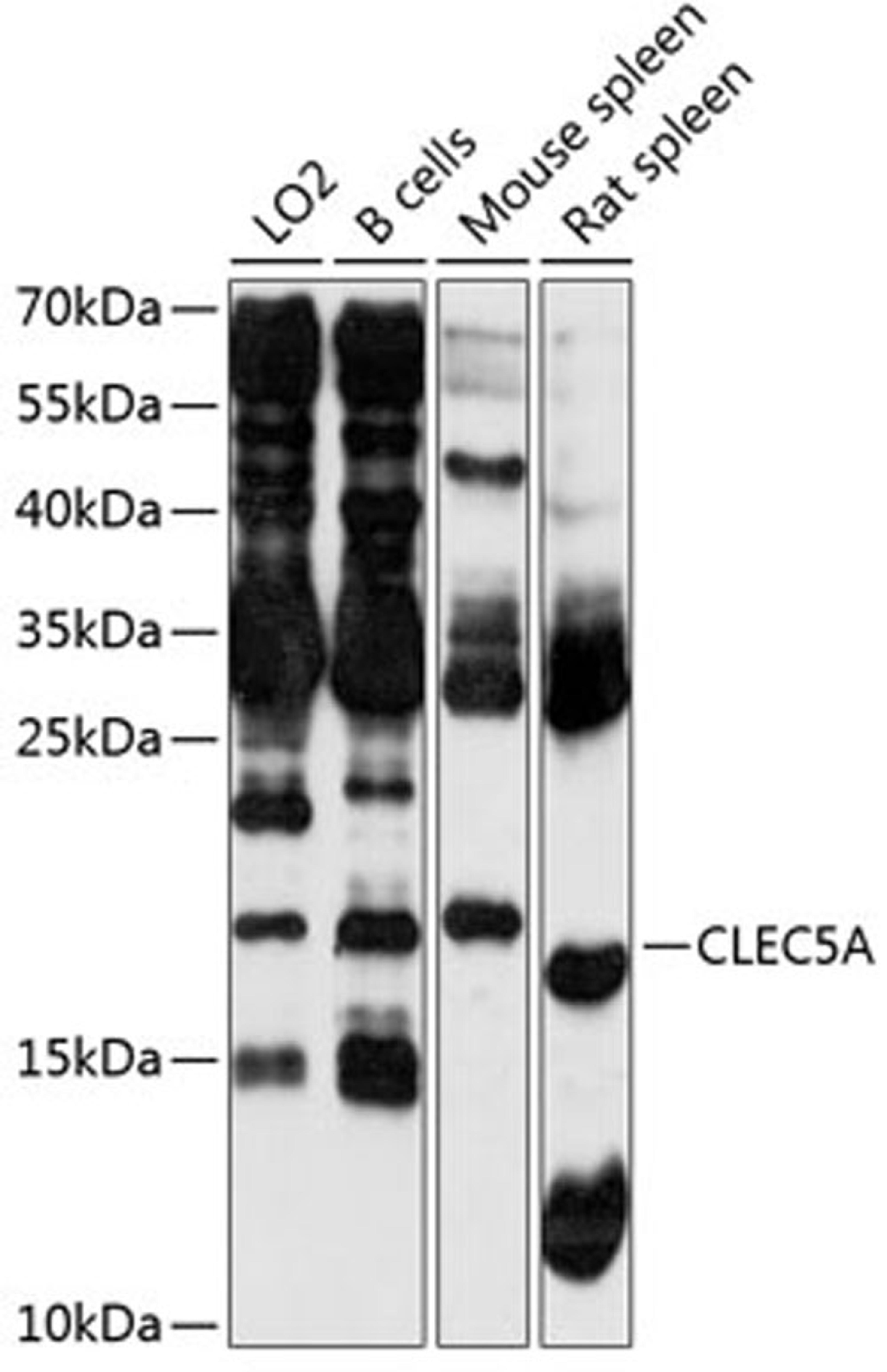 Western blot - CLEC5A antibody (A2873)