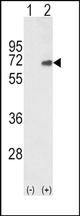 Western blot analysis of SMAD4 using rabbit polyclonal SMAD4 Antibody using 293 cell lysates (2 ug/lane) either nontransfected (Lane 1) or transiently transfected with the SMAD4 gene (Lane 2).