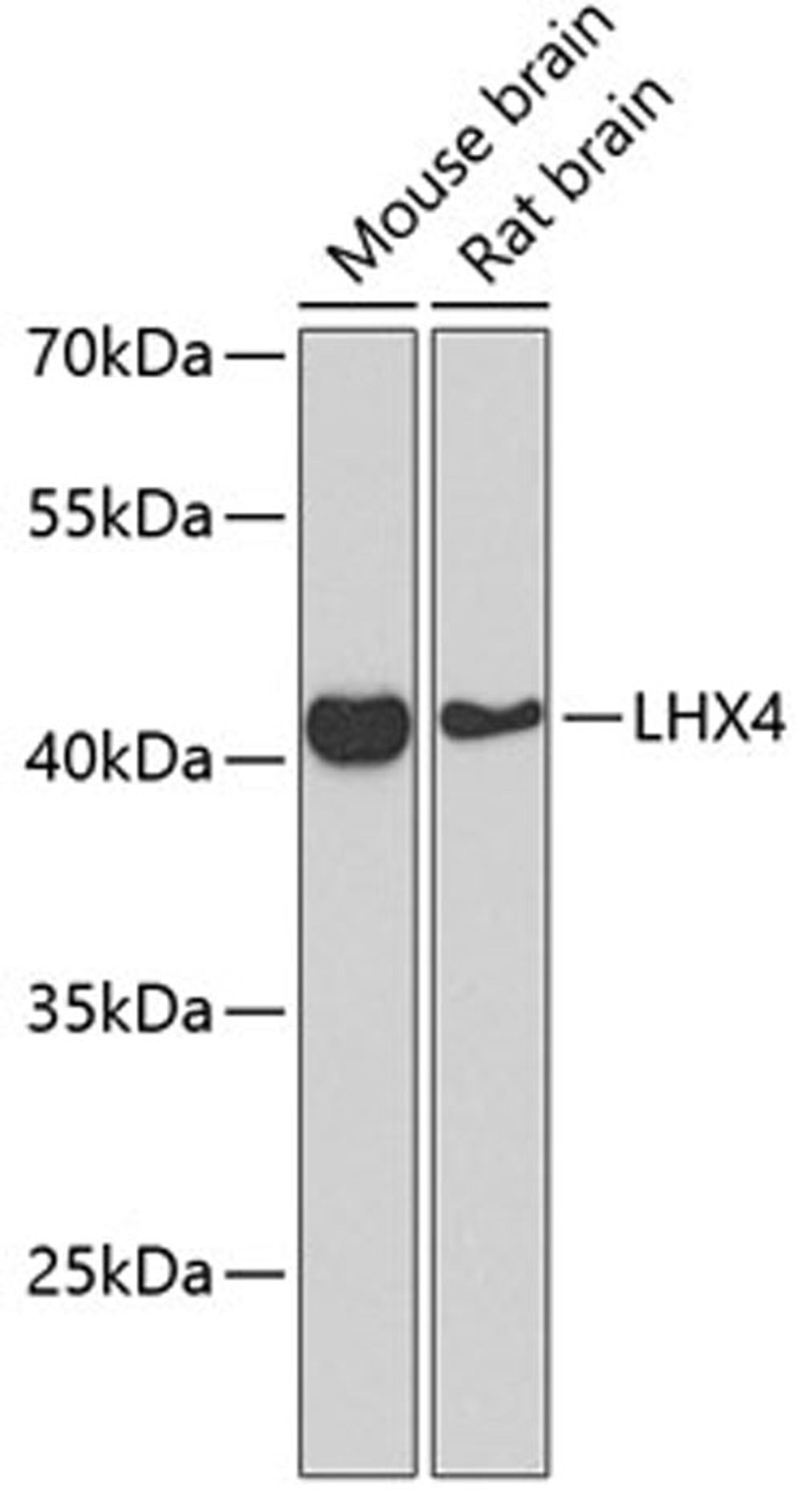 Western blot - LHX4 Antibody (A8072)