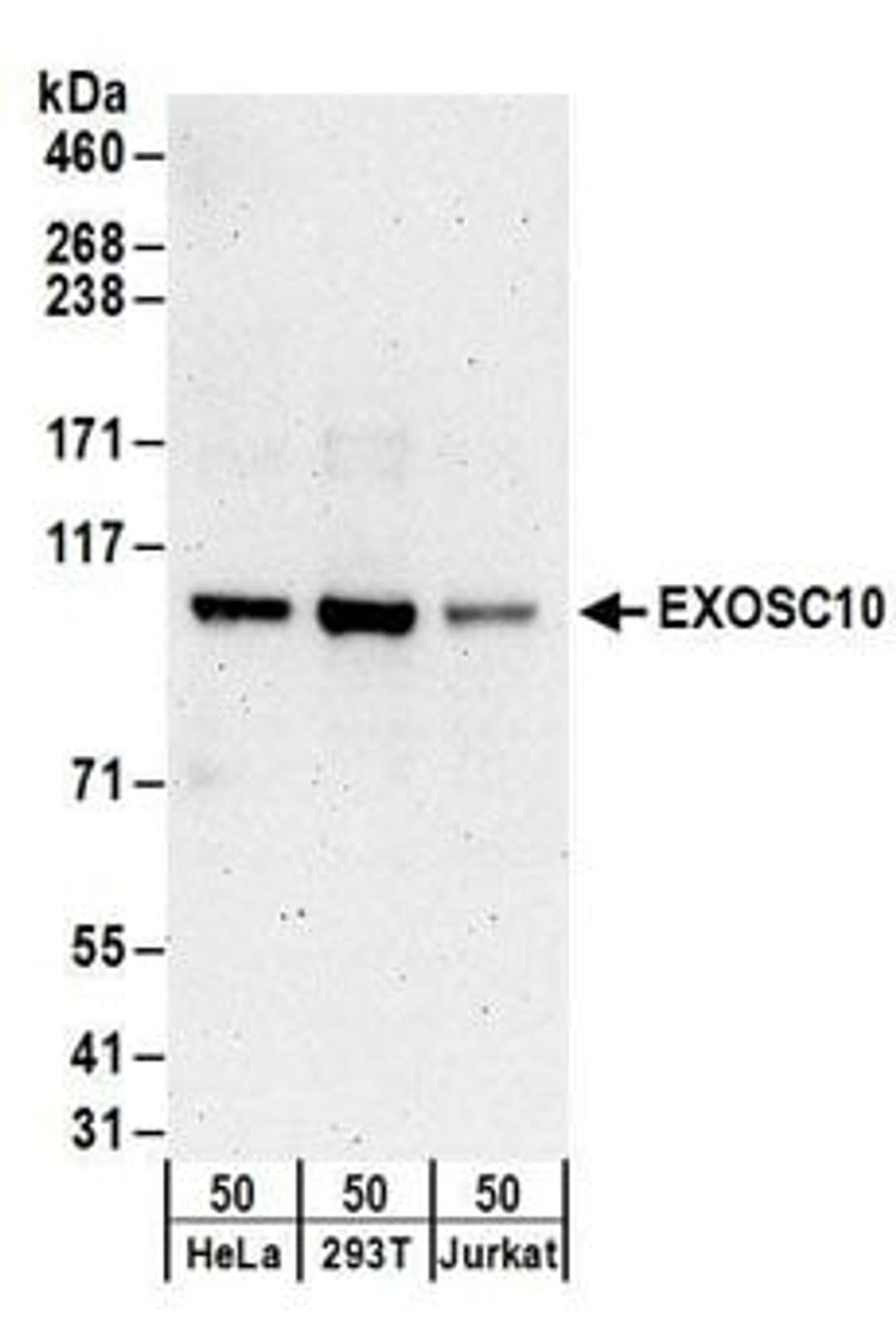 Detection of human EXOSC10 by western blot.