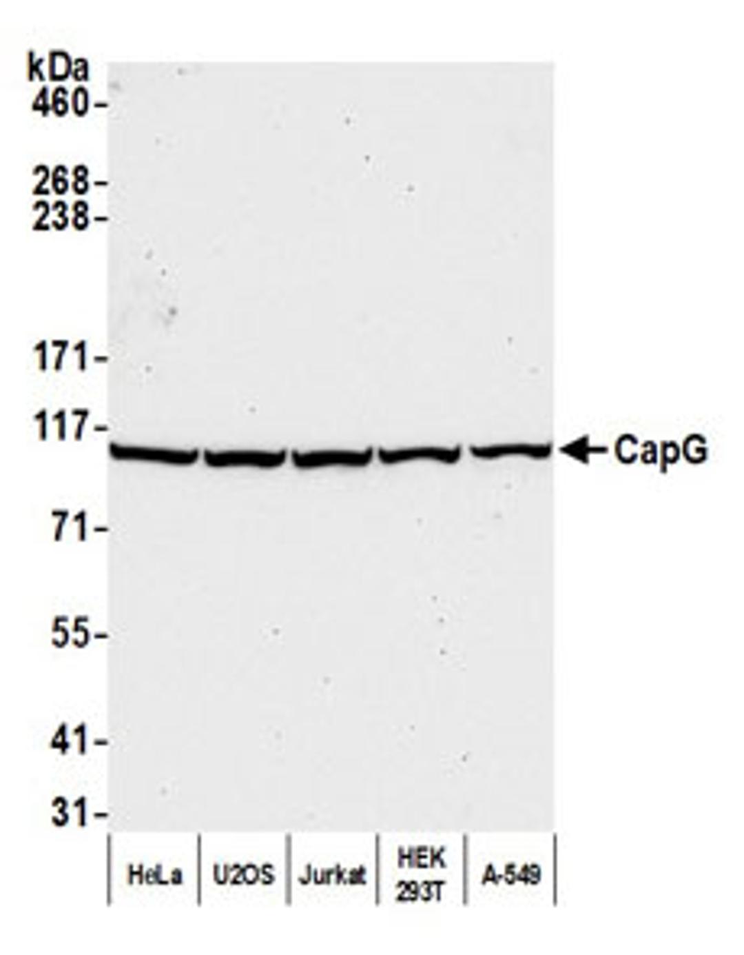 Detection of human CapG by western blot.