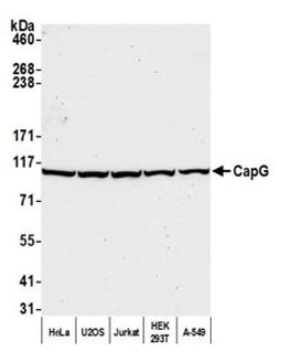 Detection of human CapG by western blot.