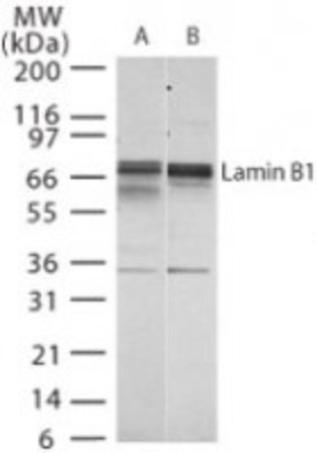 Western Blot: Lamin B1 Antibody [NB100-56403] - analysis of Lamin B1 in 30 ugs of A) HeLa and B) Hep-2 whole cell lysate using this antibody. 5 ug/ml.