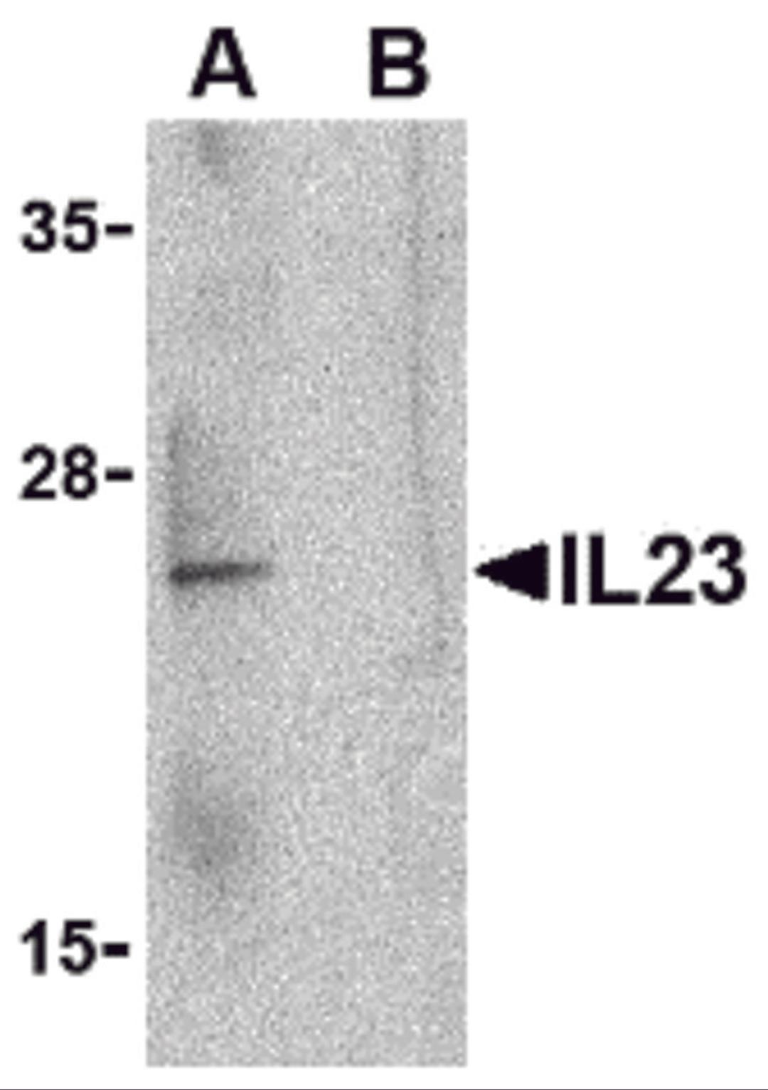 Western blot analysis of IL-23 in Raji lysate with IL-23 antibody at 1 &#956;g/mL in the (A) absence and (B) presence of blocking peptide. 