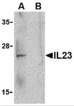 Western blot analysis of IL-23 in Raji lysate with IL-23 antibody at 1 &#956;g/mL in the (A) absence and (B) presence of blocking peptide. 