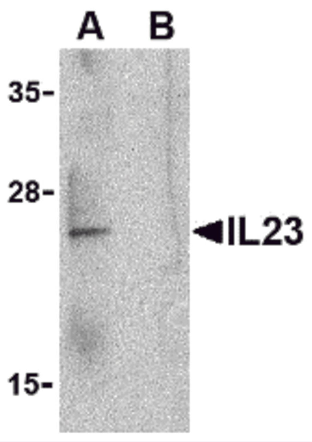 Western blot analysis of IL-23 in Raji lysate with IL-23 antibody at 1 μg/mL in the (A) absence and (B) presence of blocking peptide.