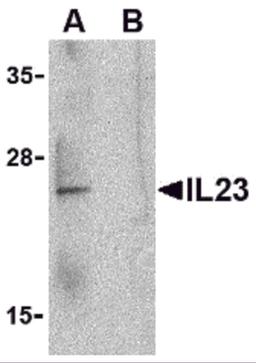Western blot analysis of IL-23 in Raji lysate with IL-23 antibody at 1 μg/mL in the (A) absence and (B) presence of blocking peptide.