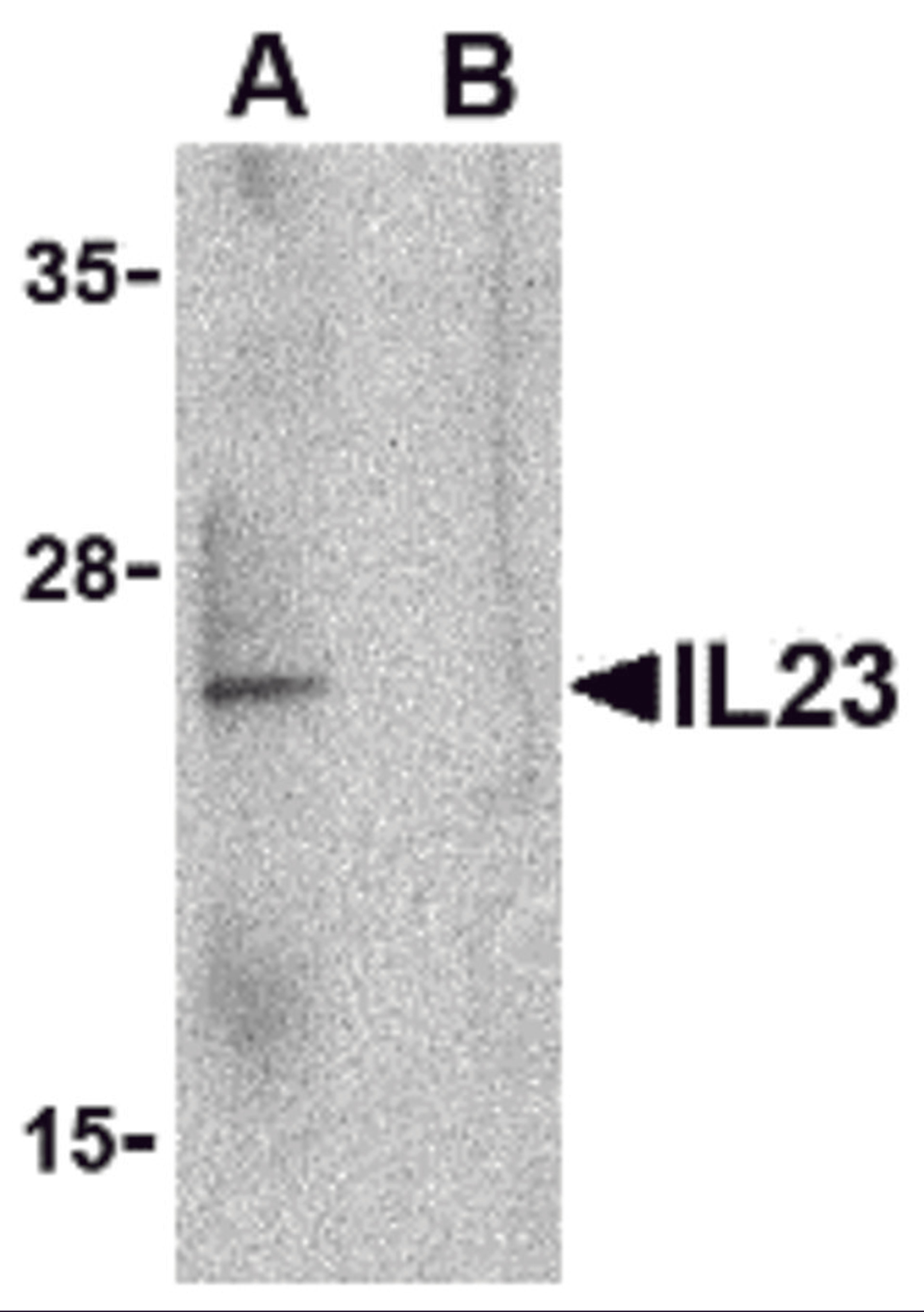 Western blot analysis of IL-23 in Raji lysate with IL-23 antibody at 1 μg/mL in the (A) absence and (B) presence of blocking peptide.