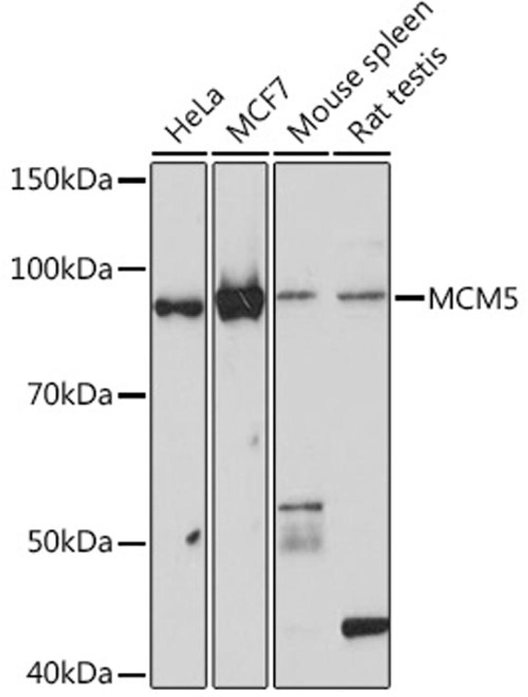 Western blot - MCM5 Rabbit mAb (A5008)