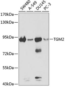 Western blot - TGM2 antibody (A0981)