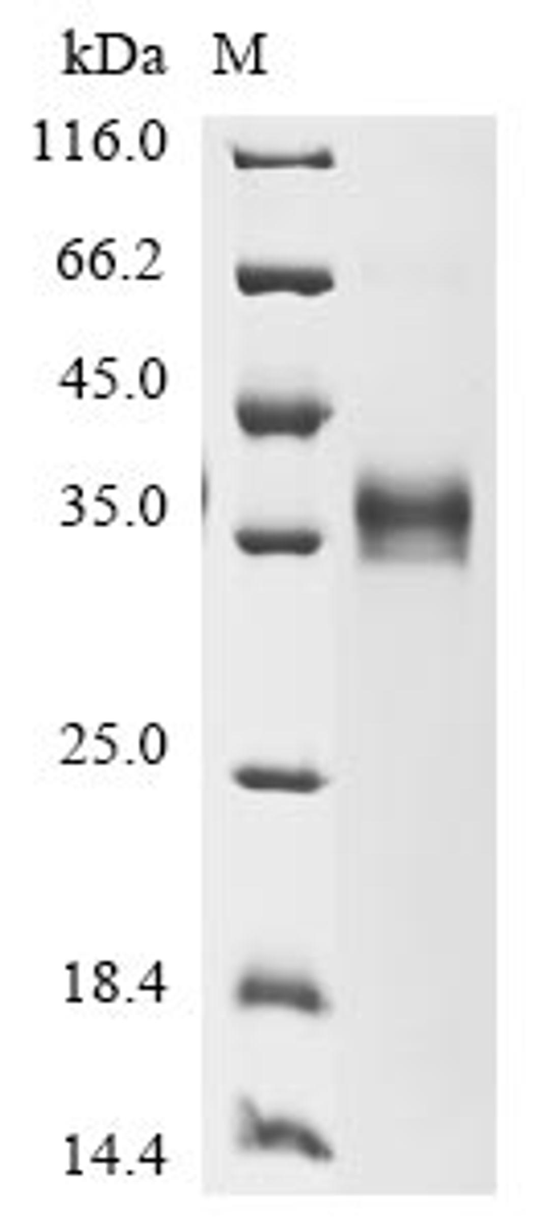 (Tris-Glycine gel) Discontinuous SDS-PAGE (reduced) with 5% enrichment gel and 15% separation gel.