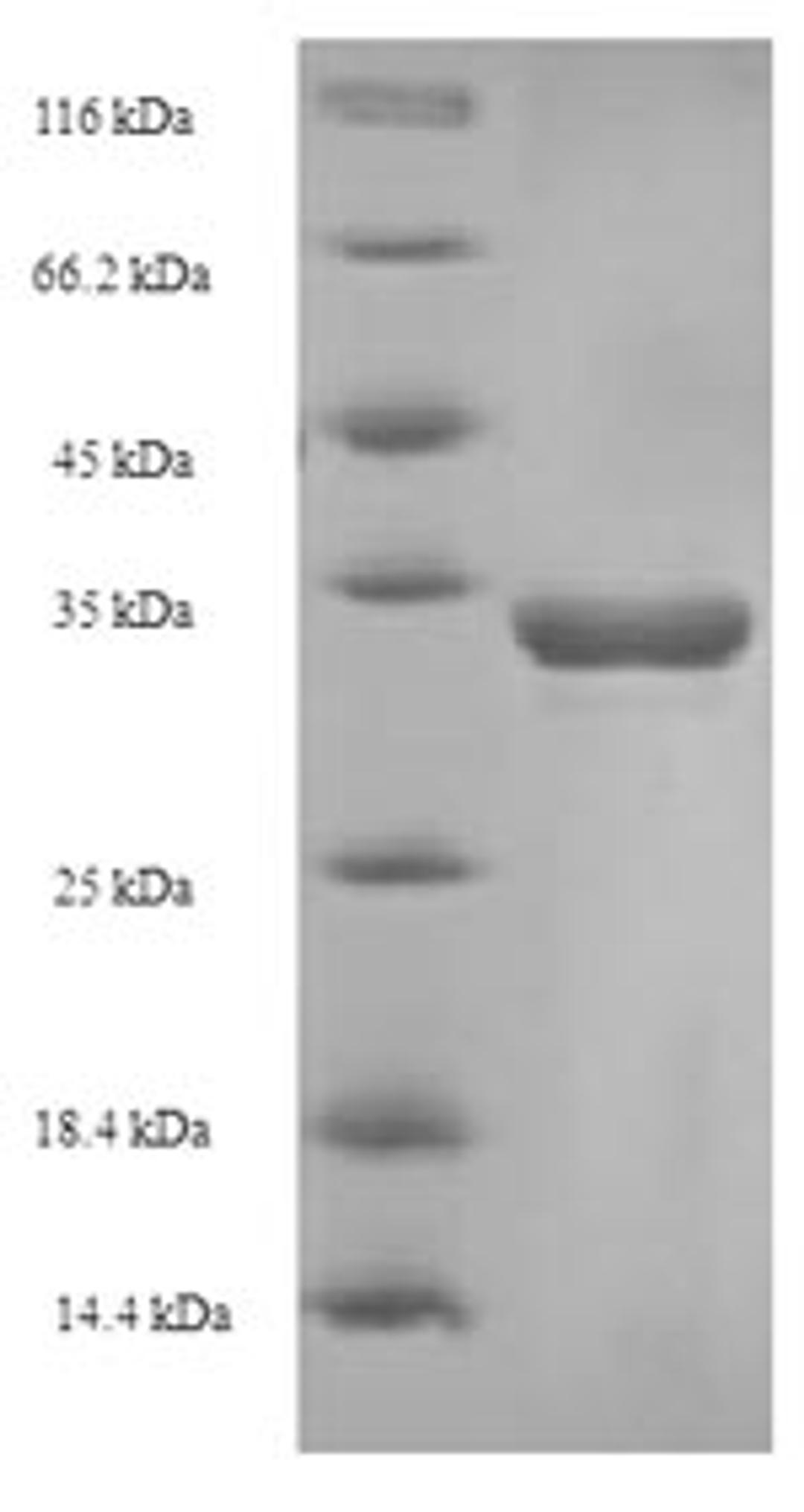 (Tris-Glycine gel) Discontinuous SDS-PAGE (reduced) with 5% enrichment gel and 15% separation gel.