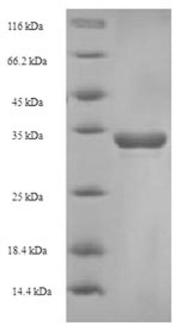(Tris-Glycine gel) Discontinuous SDS-PAGE (reduced) with 5% enrichment gel and 15% separation gel.