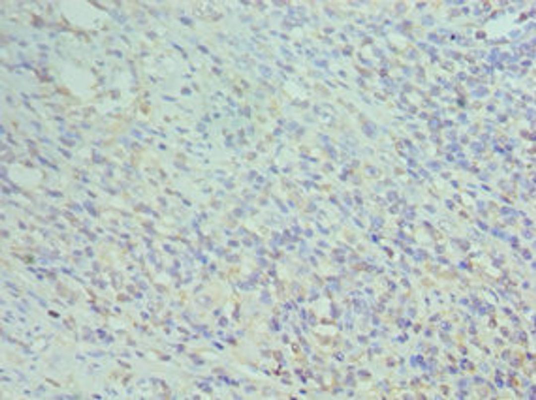 Immunohistochemistry of paraffin-embedded human epityphlon tissue using CSB-PA004956DSR1HU at dilution of 1:100