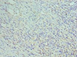 Immunohistochemistry of paraffin-embedded human epityphlon tissue using CSB-PA004956DSR1HU at dilution of 1:100