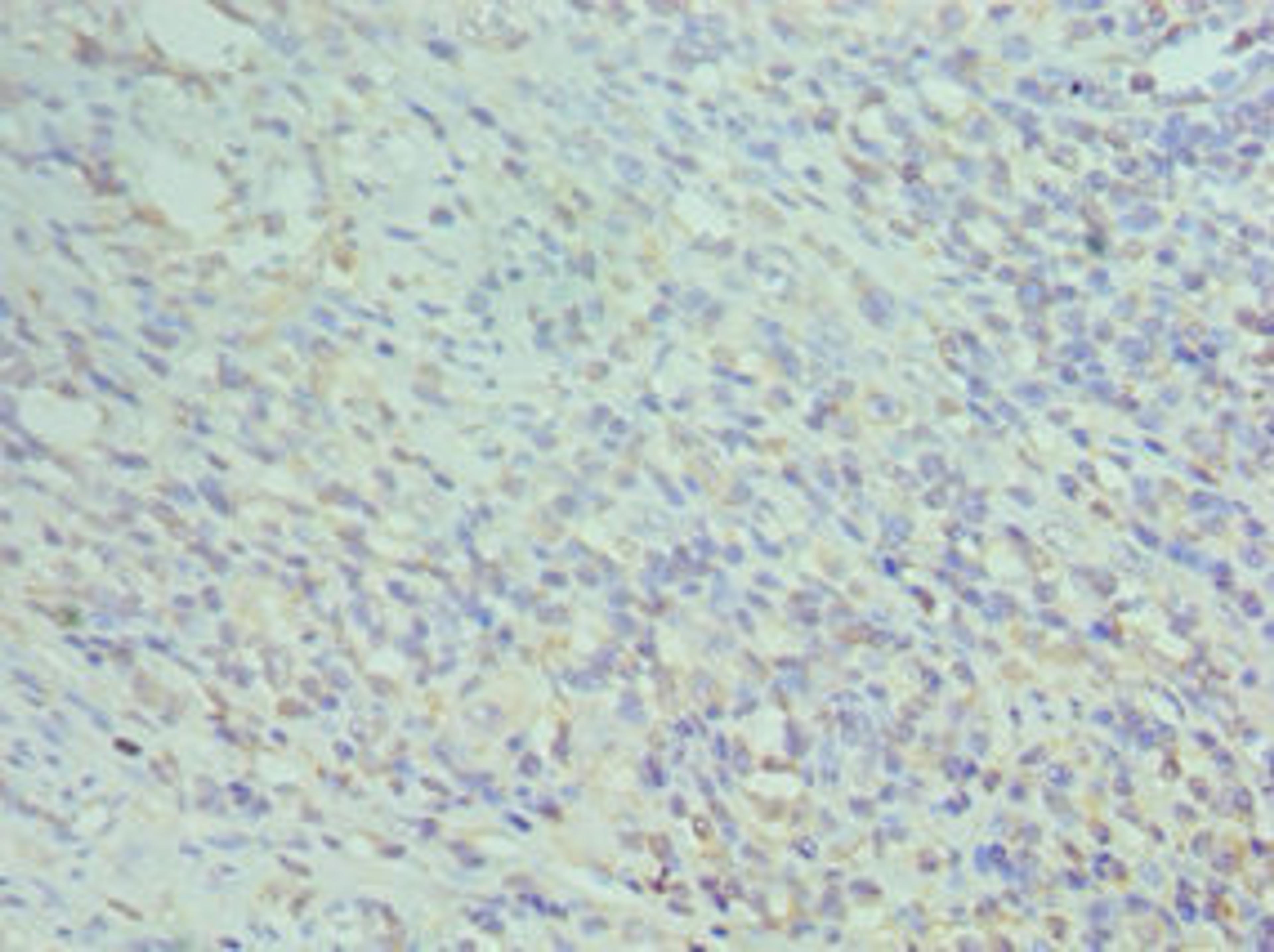 Immunohistochemistry of paraffin-embedded human epityphlon tissue using CSB-PA004956DSR1HU at dilution of 1:100