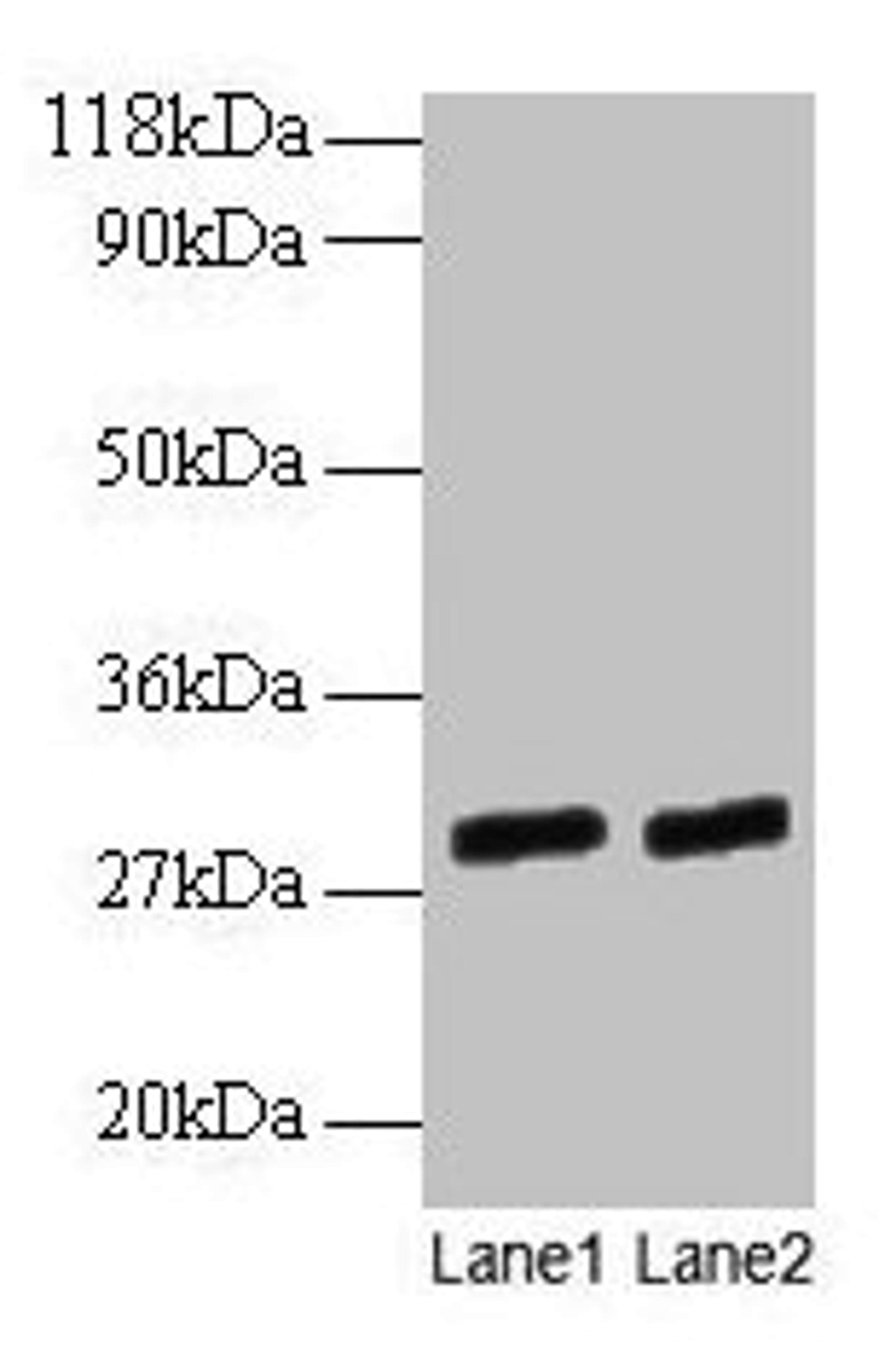 Western blot. All lanes: GATD3A antibody at 2µg/ml. Lane 1: EC109 whole cell lysate. Lane 2: 293T whole cell lysate. Secondary. Goat polyclonal to rabbit IgG at 1/15000 dilution. Predicted band size: 29, 25 kDa. Observed band size: 29 kDa