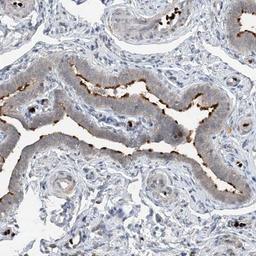 Immunohistochemistry: DNAH7 Antibody [NBP1-93613] - Staining of human fallopian tube shows positivity in cilia.