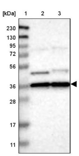 Western Blot: Olig3 Antibody [NBP1-88627] - Lane 1: Marker [kDa] 230, 130, 95, 72, 56, 36, 28, 17, 11<br/>Lane 2: Human cell line RT-4<br/>Lane 3: Human cell line U-251MG sp