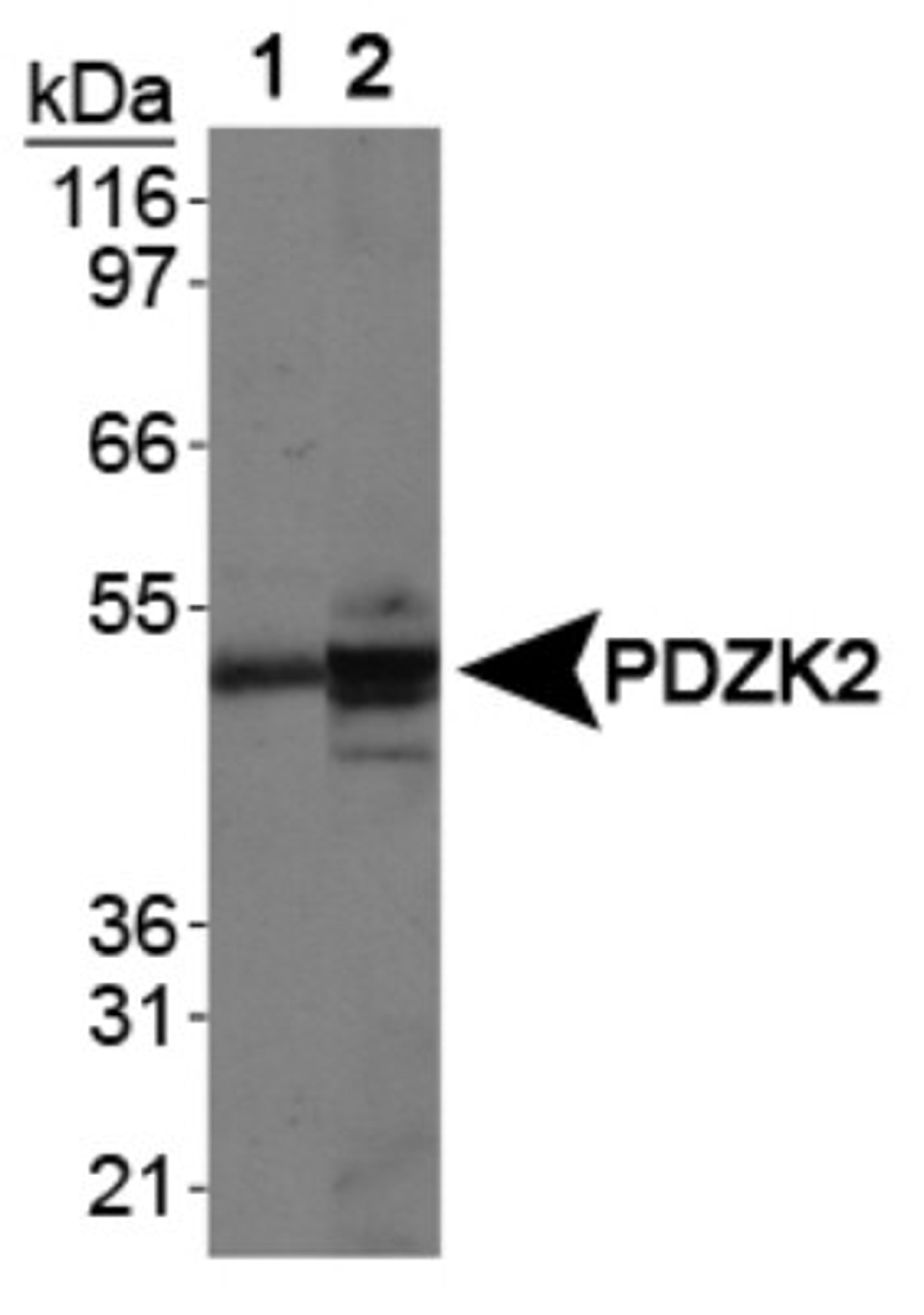 Western Blot: IKEPP Antibody [NB400-150] - Analysis on Lane 1: human kidney membrane lysate and Lane 2: mouse kidney membrane lysate.