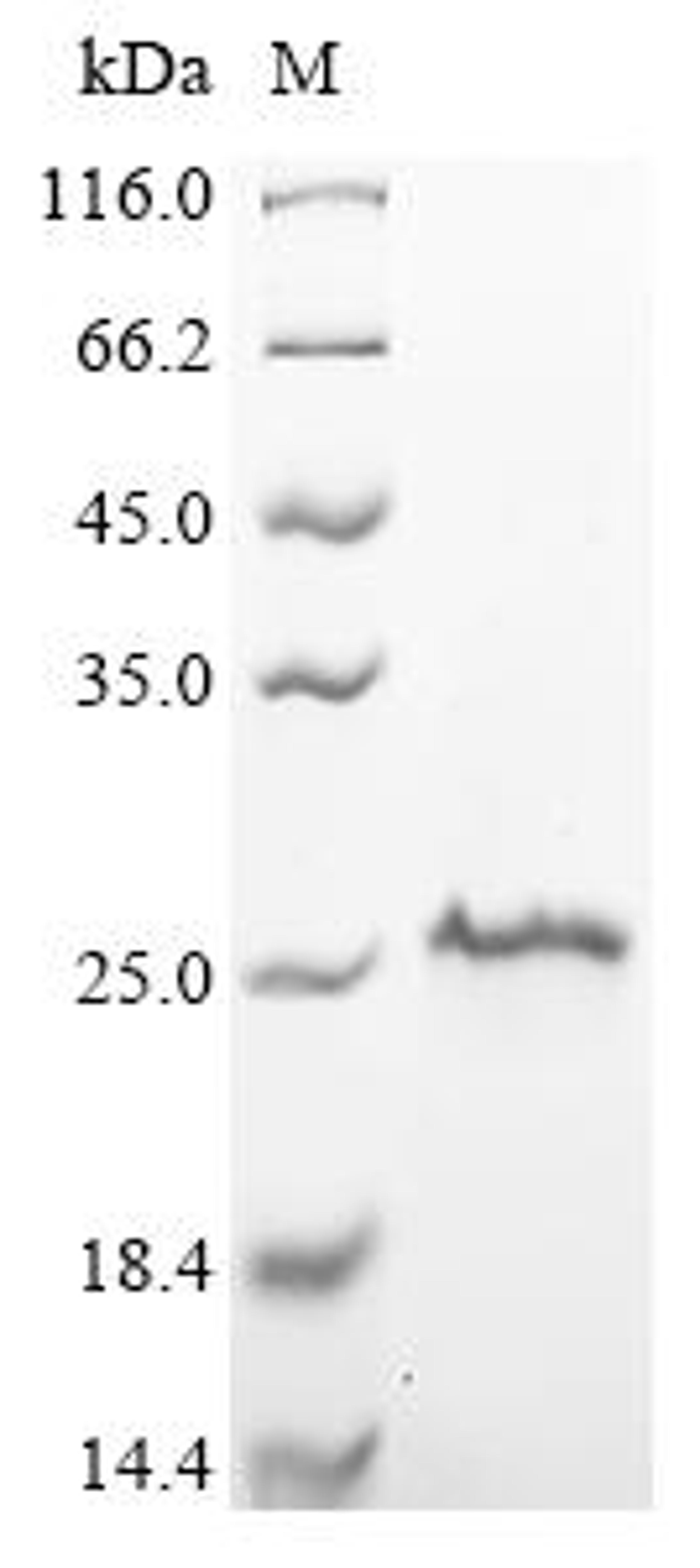 (Tris-Glycine gel) Discontinuous SDS-PAGE (reduced) with 5% enrichment gel and 15% separation gel.