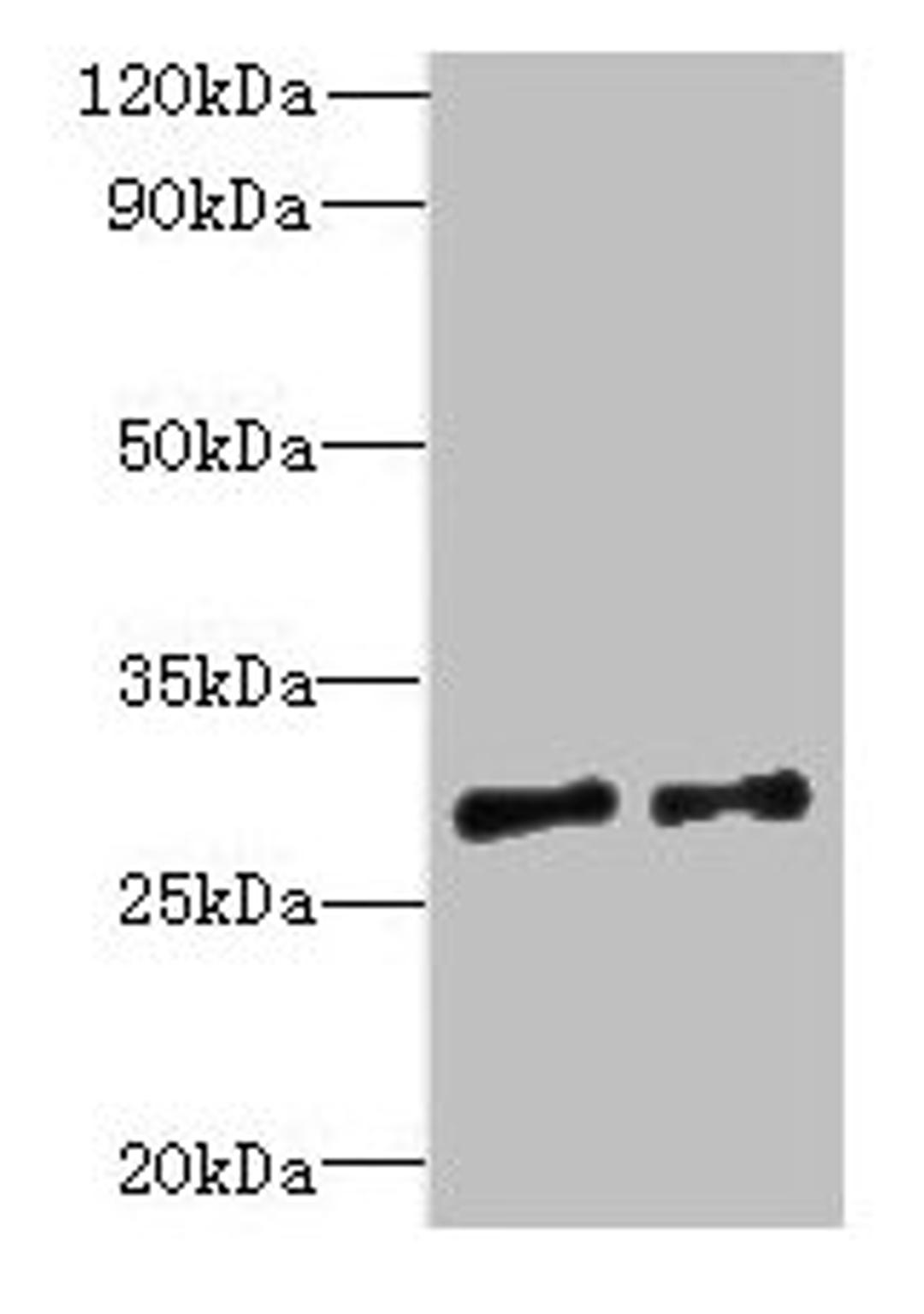Western blot. All lanes: TEX47 antibody at 8µg/ml. Lane 1: Jurkat whole cell lysate. Lane 2: A549 whole cell lysate. Secondary. Goat polyclonal to rabbit IgG at 1/10000 dilution. Predicted band size: 30 kDa. Observed band size: 30 kDa