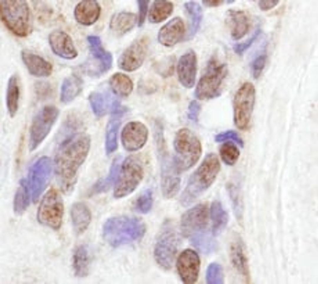 Detection of human CoAA by immunohistochemistry.