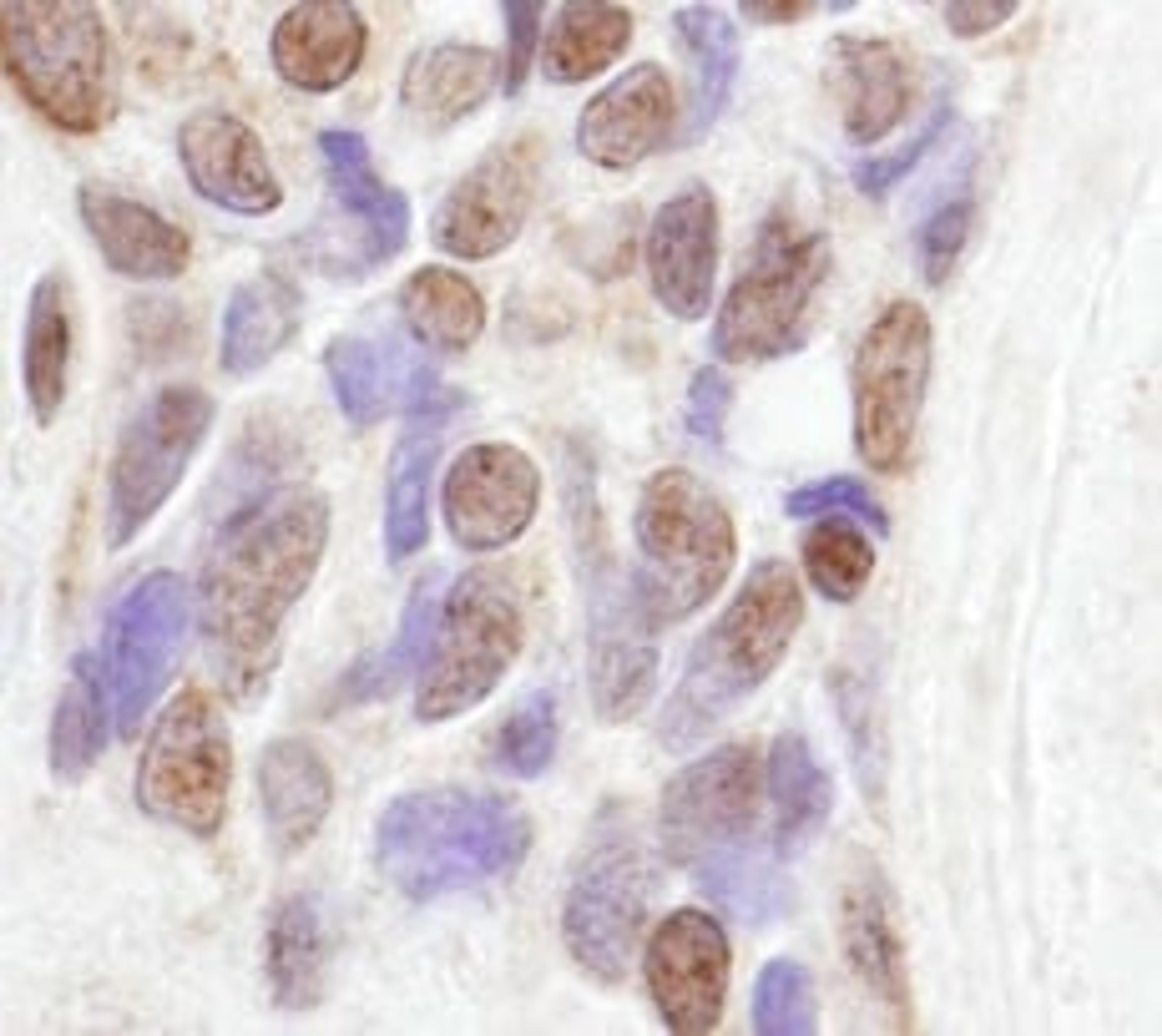 Detection of human CoAA by immunohistochemistry.