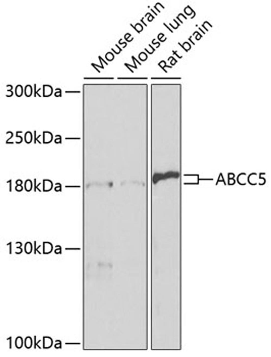 Western blot - ABCC5 antibody (A3028)