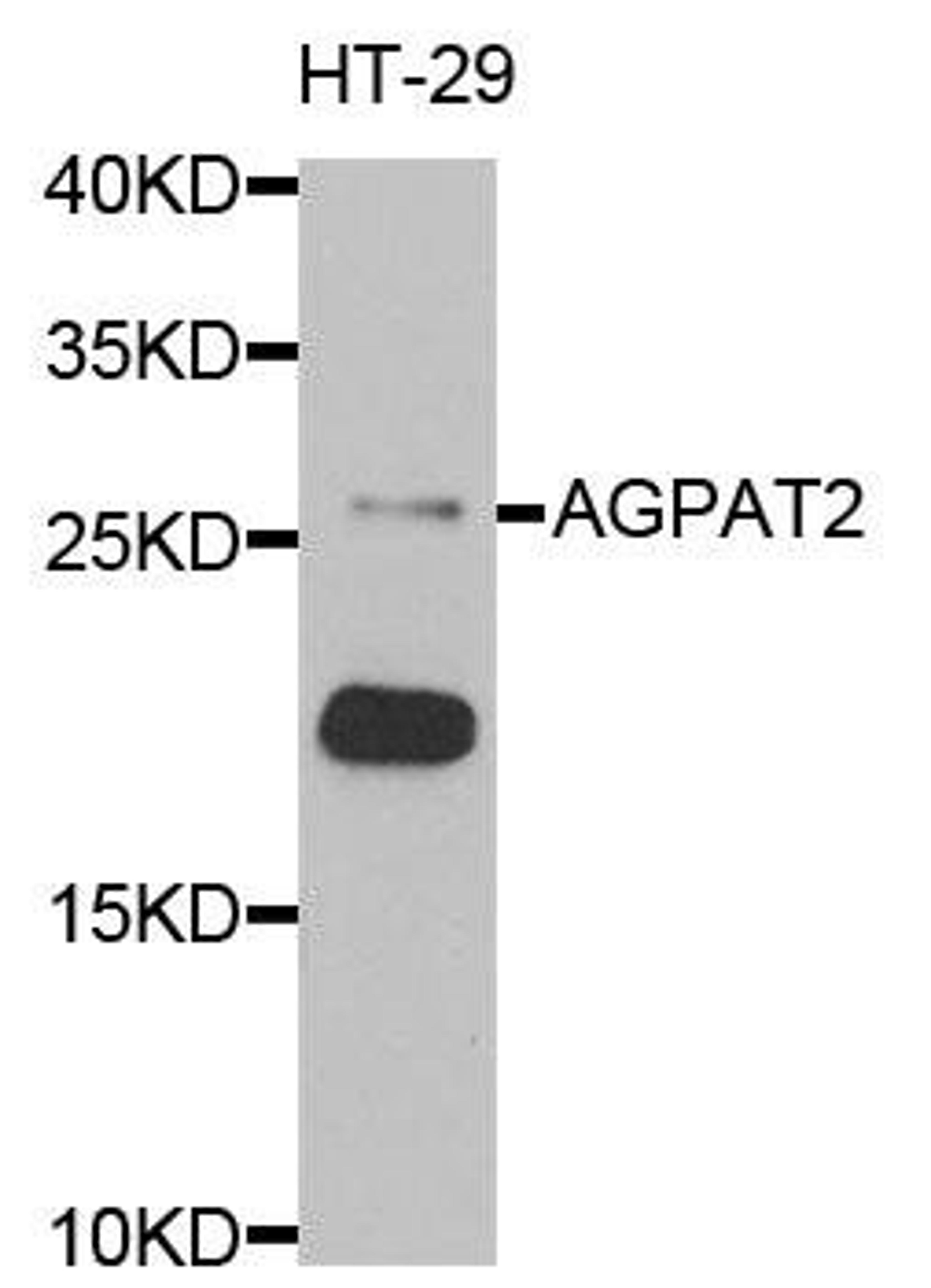 Western blot analysis of extracts of HT-29 cells using AGPAT2 antibody