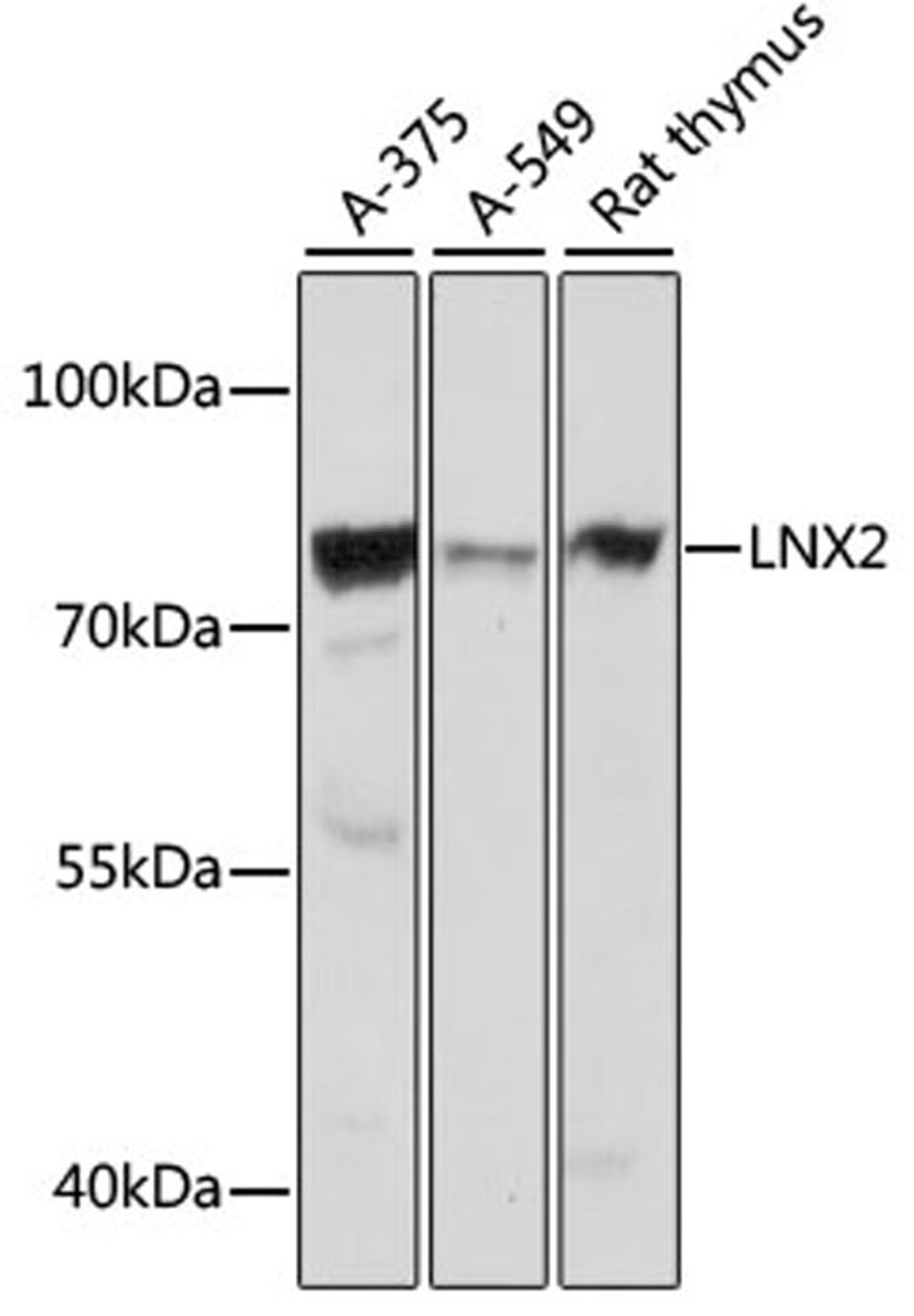 Western blot - LNX2 antibody (A16611)