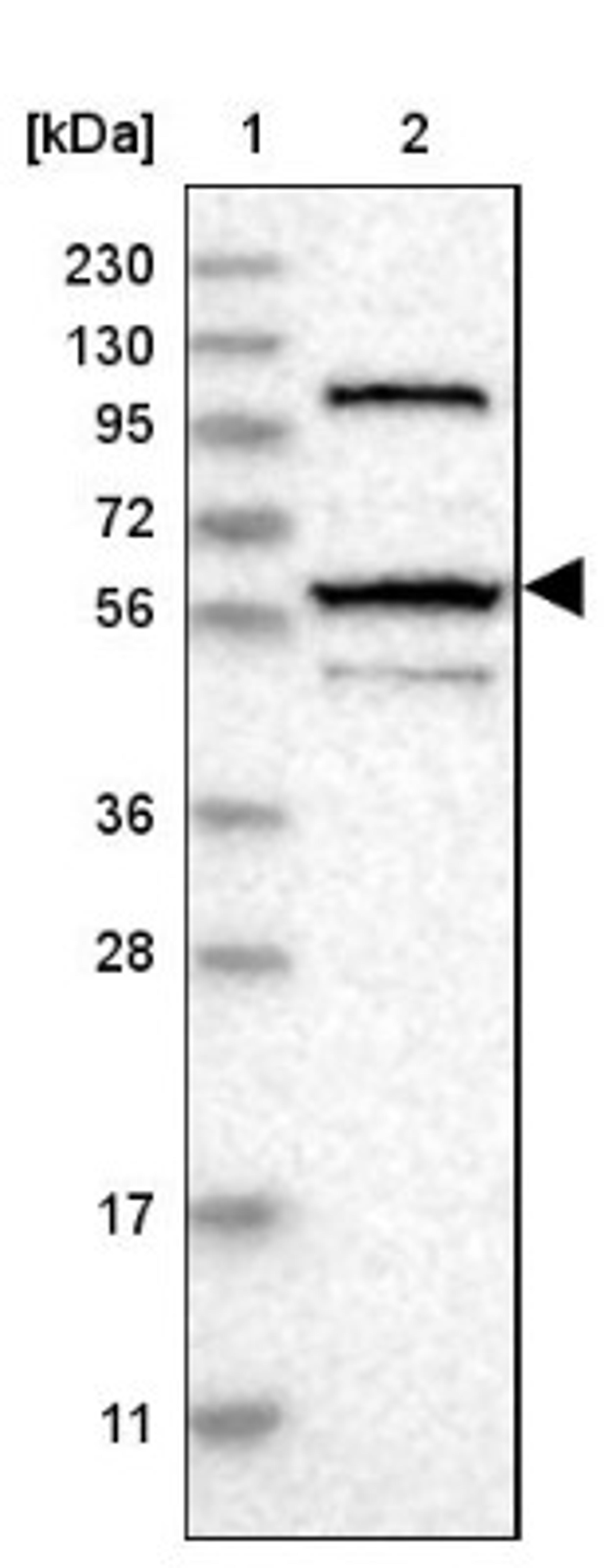 Western Blot: ZNF454 Antibody [NBP1-81948] - Lane 1: Marker [kDa] 230, 130, 95, 72, 56, 36, 28, 17, 11<br/>Lane 2: Human cell line RT-4