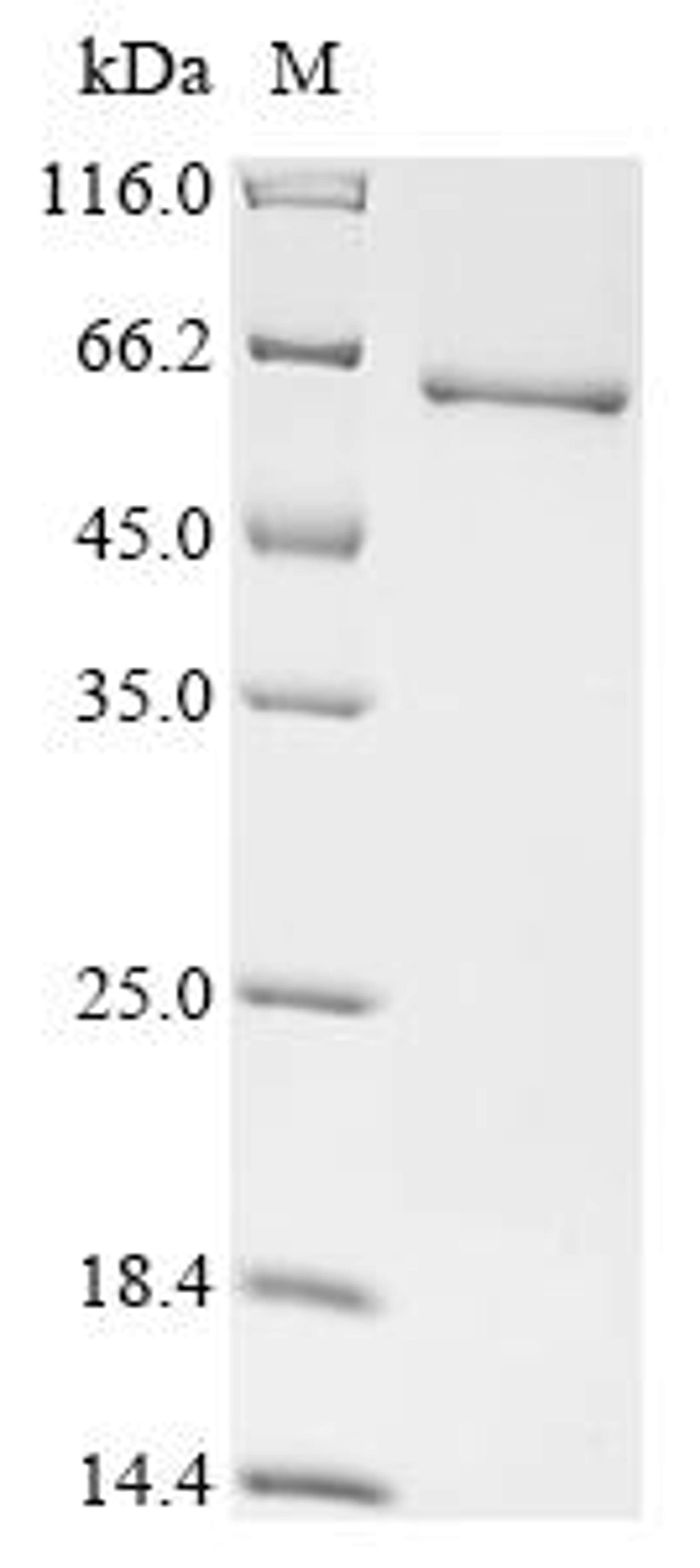 (Tris-Glycine gel) Discontinuous SDS-PAGE (reduced) with 5% enrichment gel and 15% separation gel.