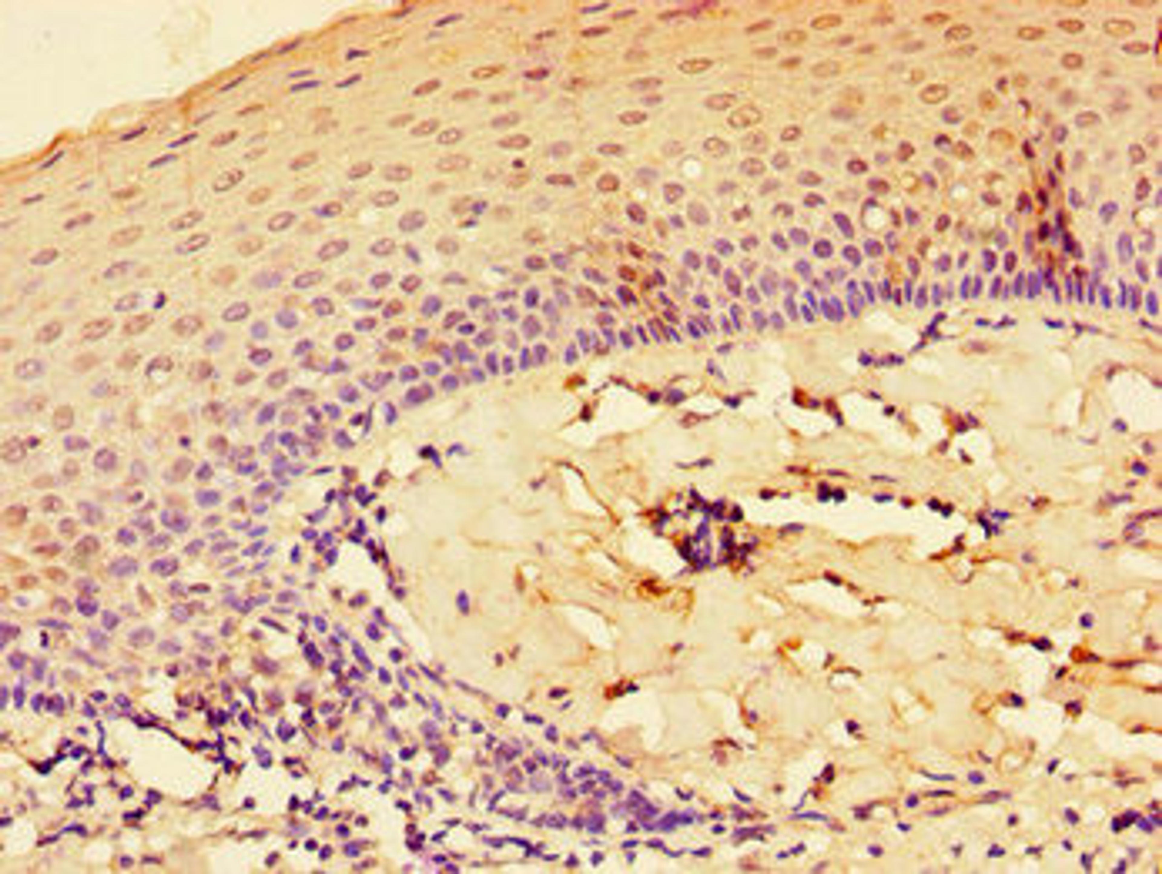 Immunohistochemistry of paraffin-embedded human tonsil tissue using CSB-PA011656LA01HU at dilution of 1:100