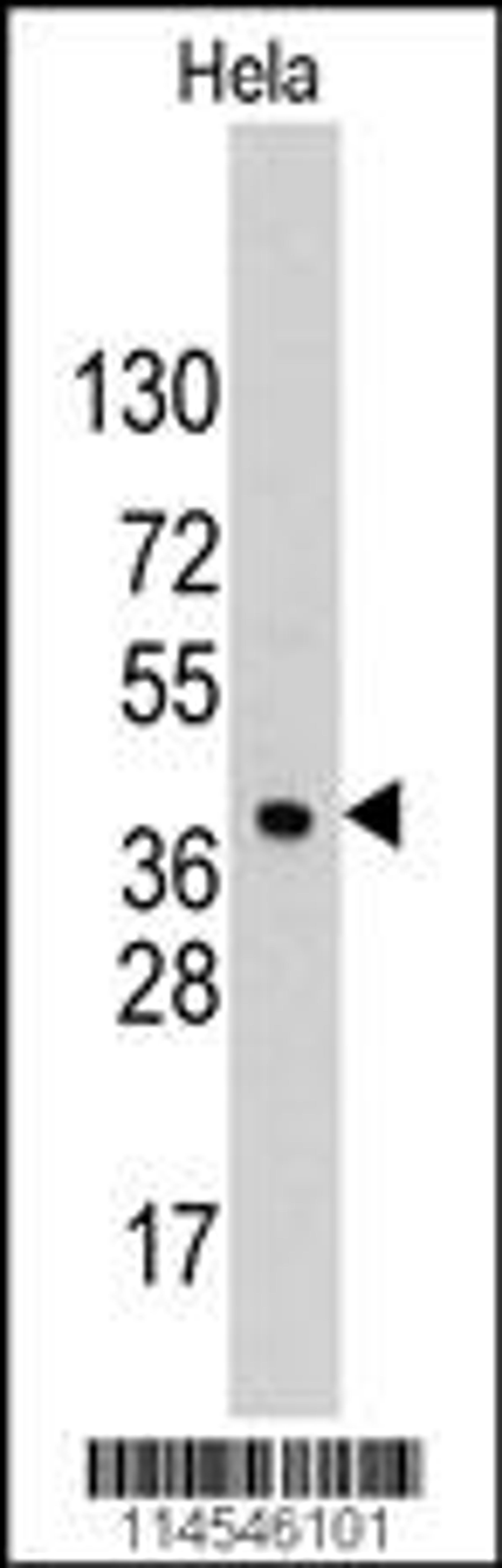 Western blot analysis of anti-HDGF Pab in Hela cell line lysates (35ug/lane)