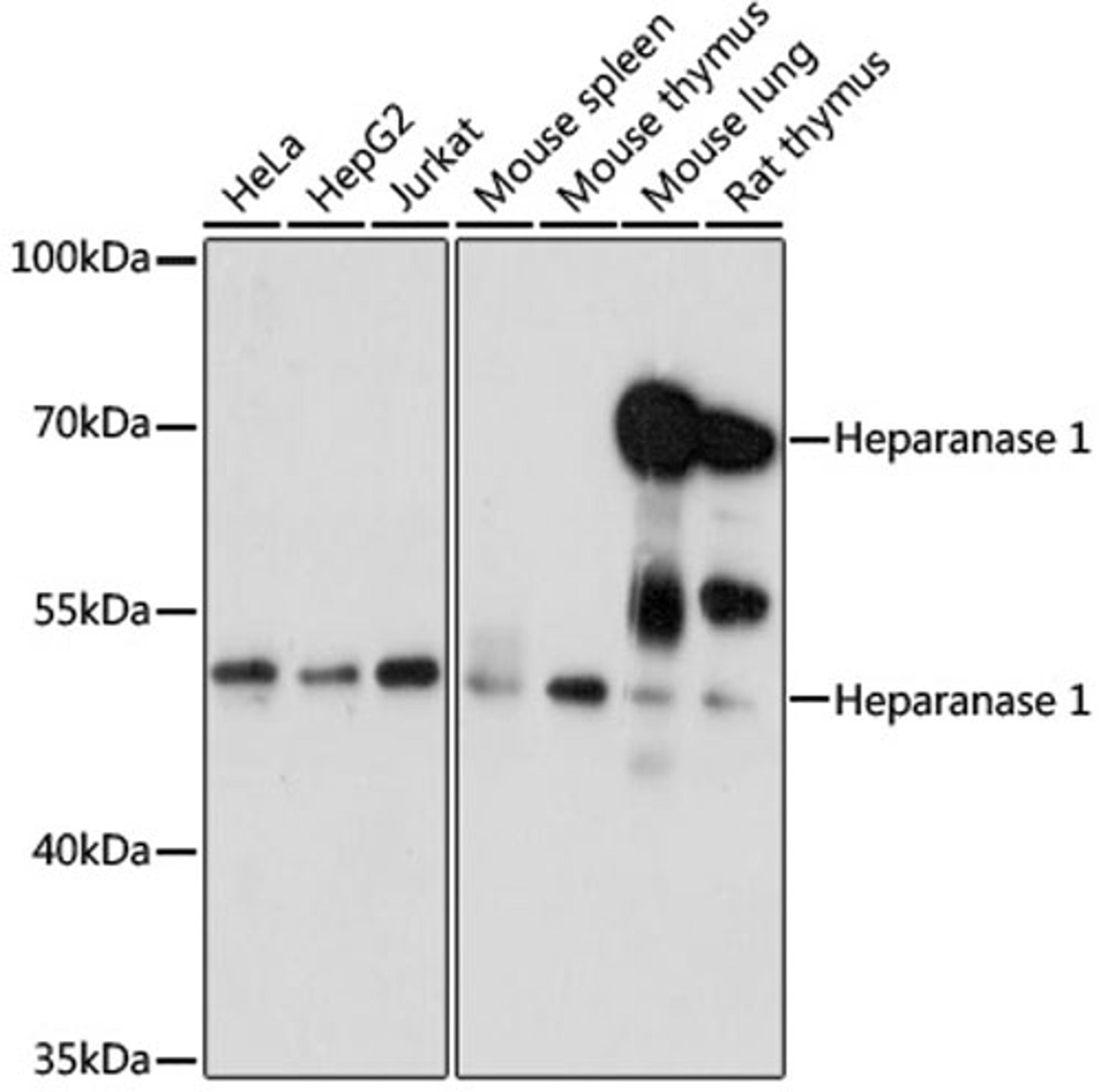 Western blot - Heparanase 1 antibody (A5726)