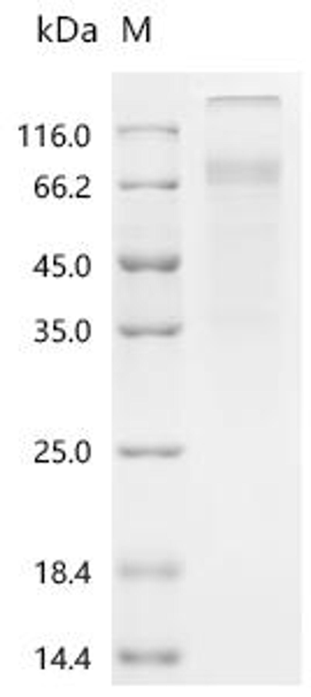 (Tris-Glycine gel) Discontinuous SDS-PAGE (reduced) with 5% enrichment gel and 15% separation gel.