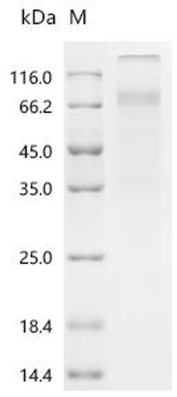 (Tris-Glycine gel) Discontinuous SDS-PAGE (reduced) with 5% enrichment gel and 15% separation gel.