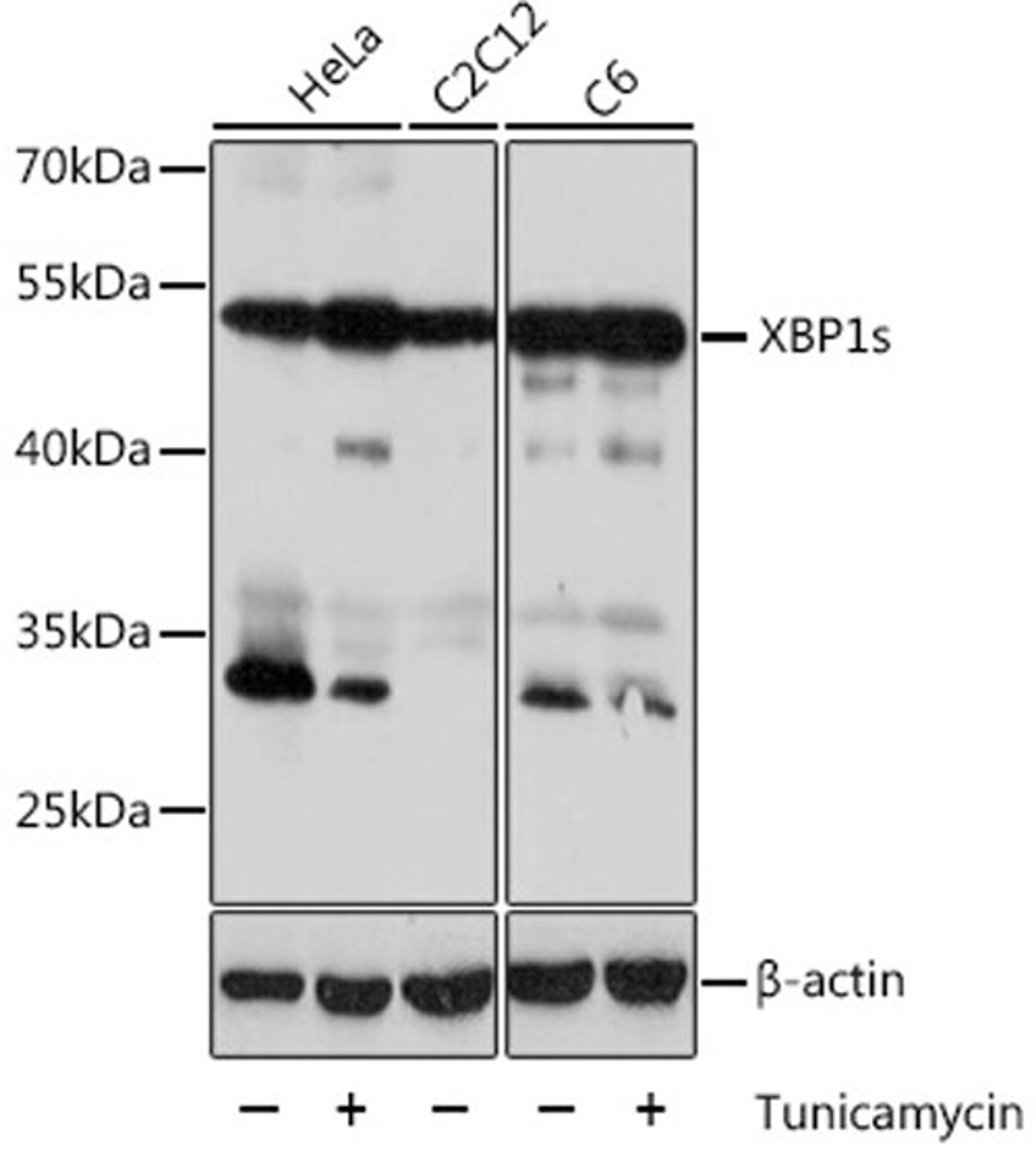 Western blot - XBP1s antibody (A17007)