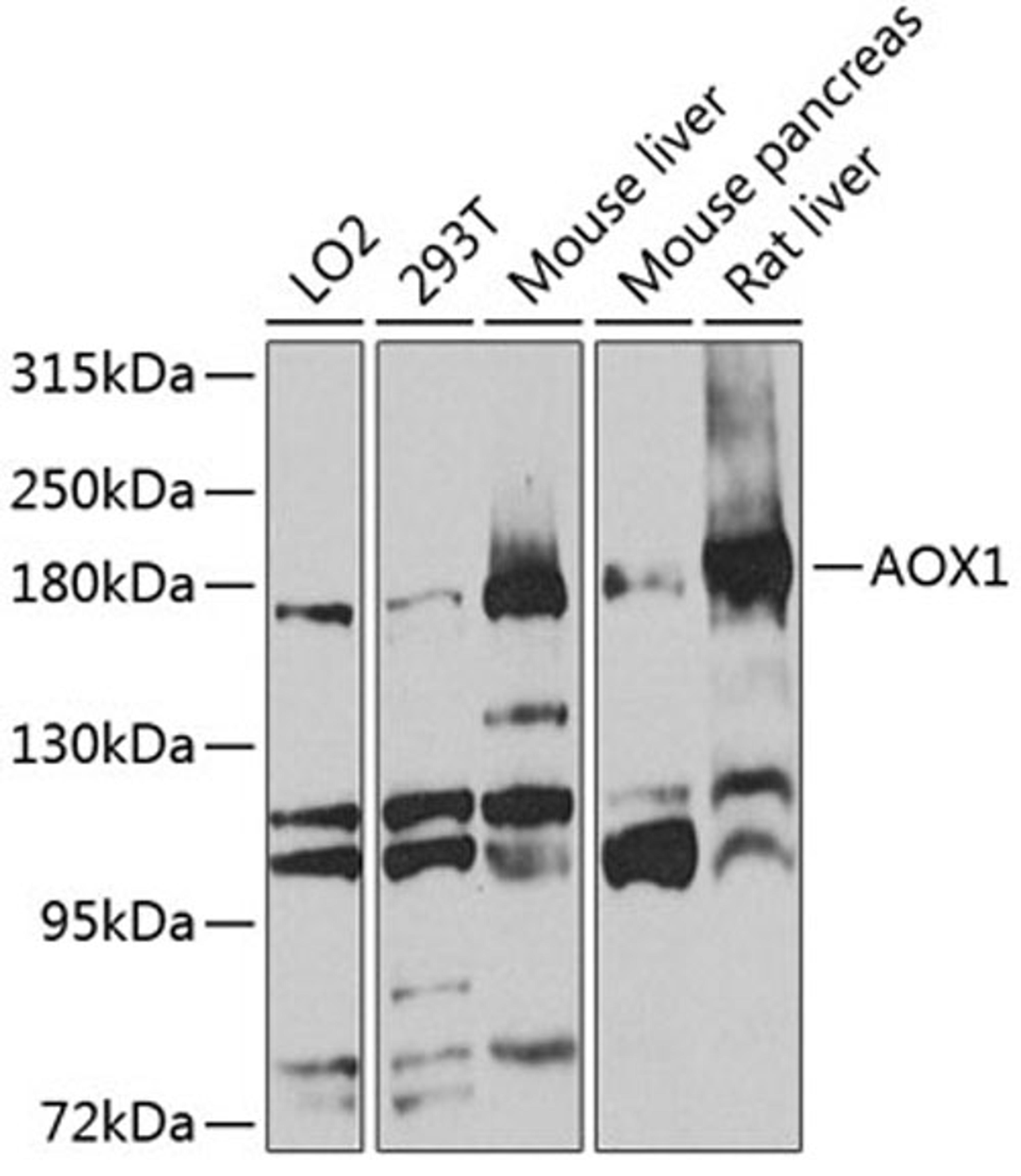 Western blot - AOX1 antibody (A3586)