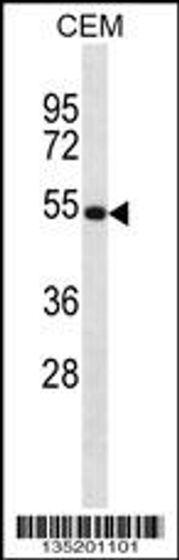 Western blot analysis in CEM cell line lysates (35ug/lane).