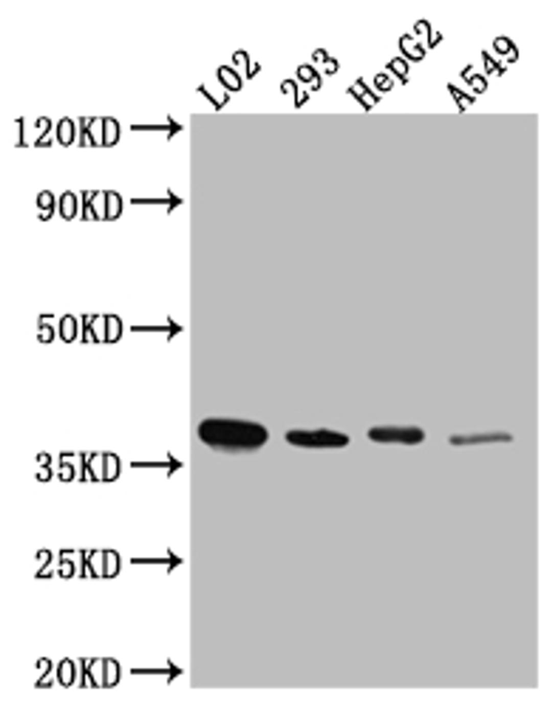 Western Blot. Positive WB detected in: L02 whole cell lysate, HEK293 whole cell lysate, HepG2 whole cell lysate, A549 whole cell lysate. All lanes: LRG1 antibody at 1:1000. Secondary. Goat polyclonal to rabbit IgG at 1/50000 dilution. Predicted band size: 39 kDa. Observed band size: 39 kDa.