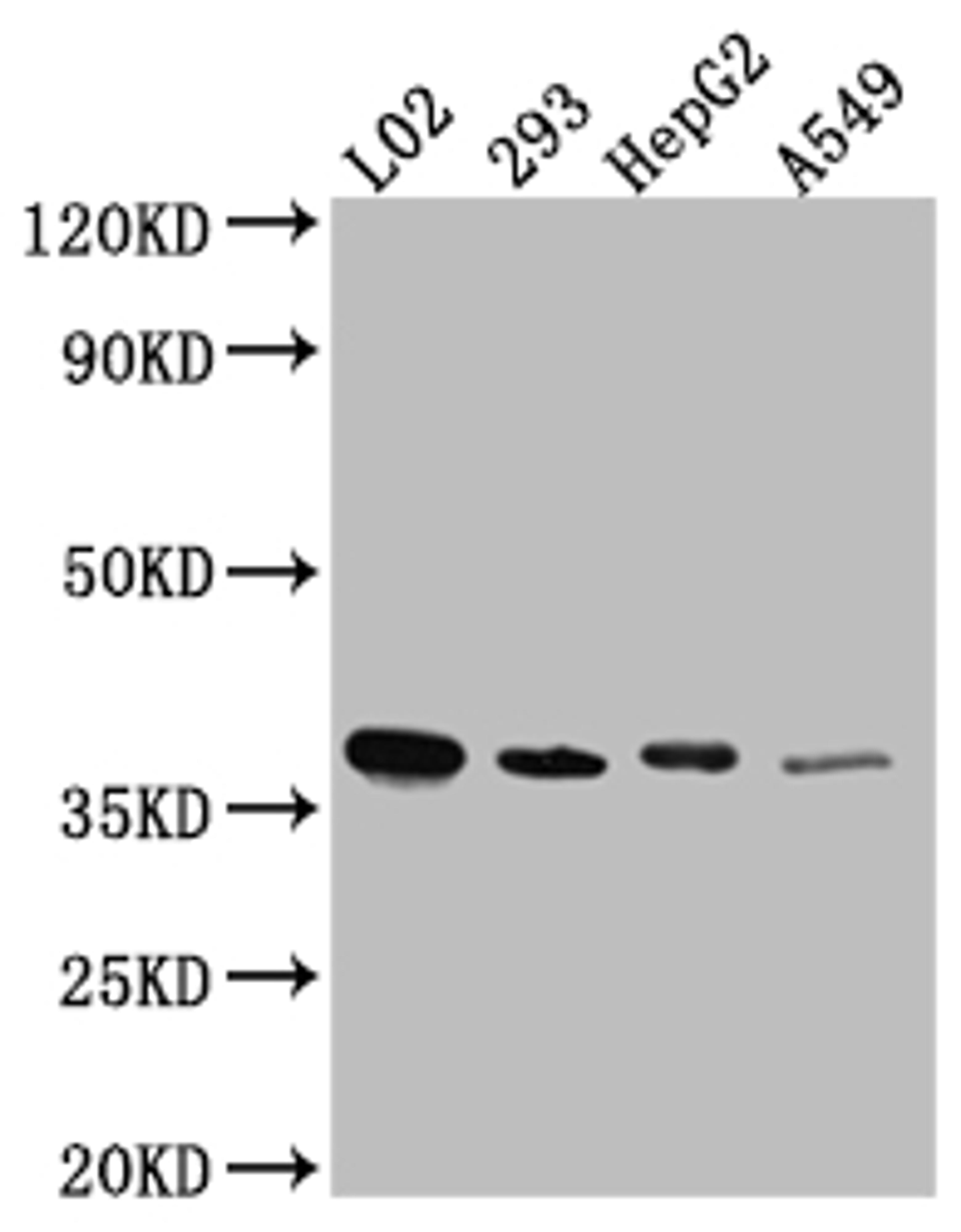 Western Blot. Positive WB detected in: L02 whole cell lysate, HEK293 whole cell lysate, HepG2 whole cell lysate, A549 whole cell lysate. All lanes: LRG1 antibody at 1:1000. Secondary. Goat polyclonal to rabbit IgG at 1/50000 dilution. Predicted band size: 39 kDa. Observed band size: 39 kDa.