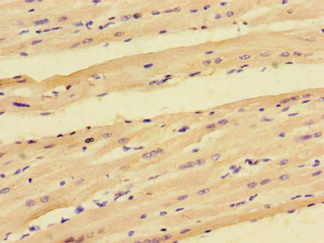 Immunohistochemistry of paraffin-embedded human heart tissue using CSB-PA871627LA01HU at dilution of 1:100
